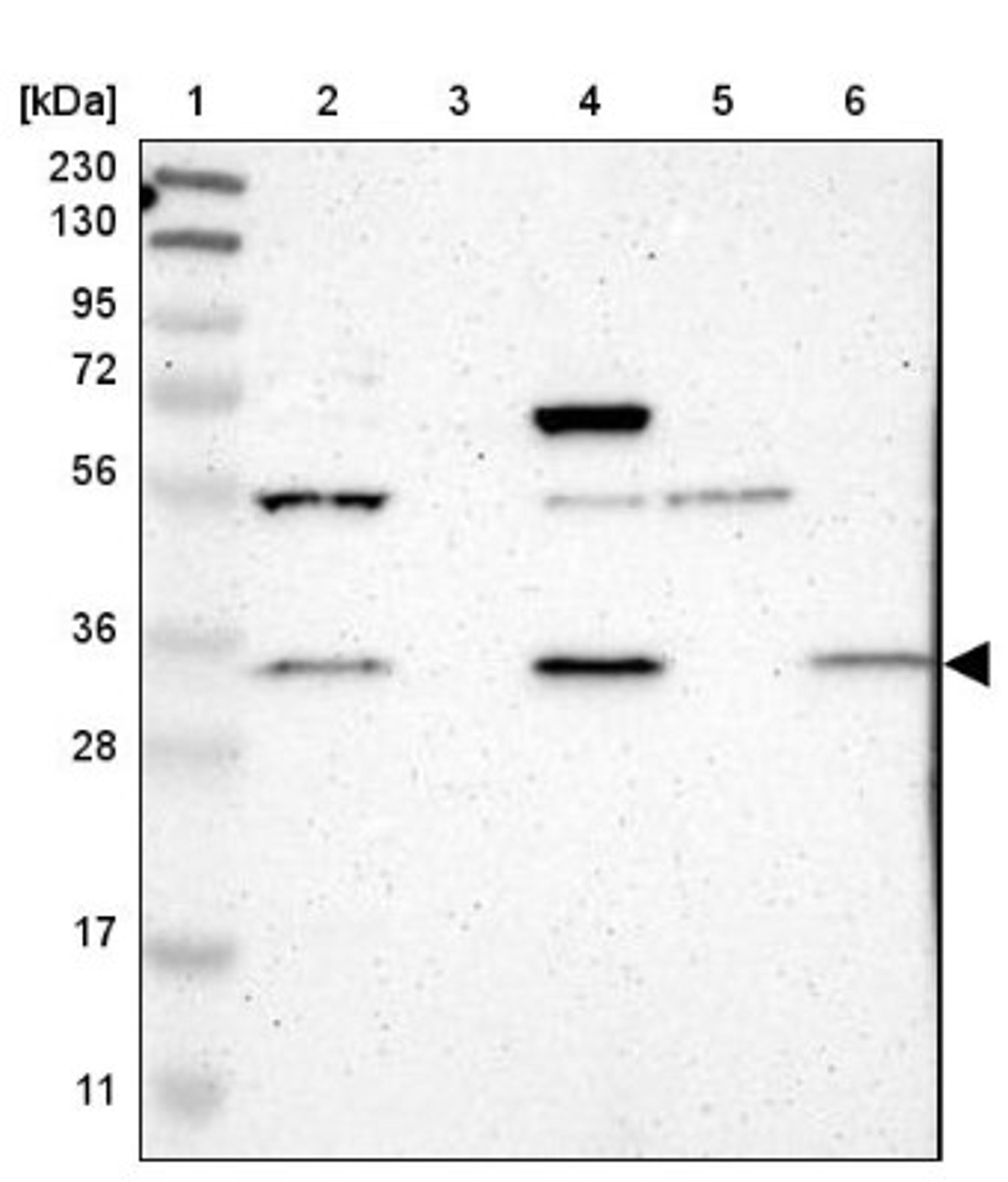 Western Blot: FAM49B Antibody [NBP1-88582] - Lane 1: Marker [kDa] 230, 130, 95, 72, 56, 36, 28, 17, 11<br/>Lane 2: Human cell line RT-4<br/>Lane 3: Human plasma (IgG/HSA depleted)<br/>Lane 4: Human cell line U-251MG sp<br/>Lane 5: Human liver tissue<br/>Lane 6: Human tonsil tissue