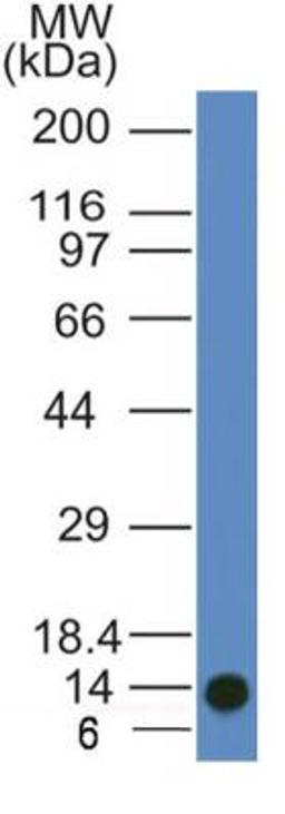 Western Blot: ATG11 Antibody (7C2NB) [NBP2-47124] - Western blot analysis of ATG11 antibody in partial recombinant ATG11 protein.