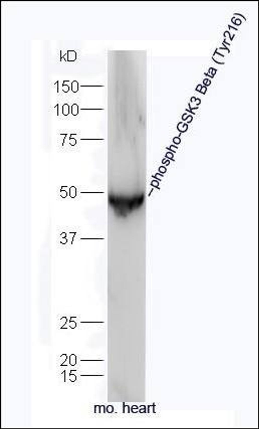 Western blot analysis of Mouse brain tissue using GSK3 beta (phospho-Tyr216) antibody.