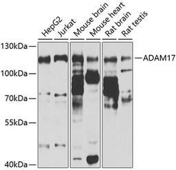 Western blot - ADAM17 antibody (A0821)