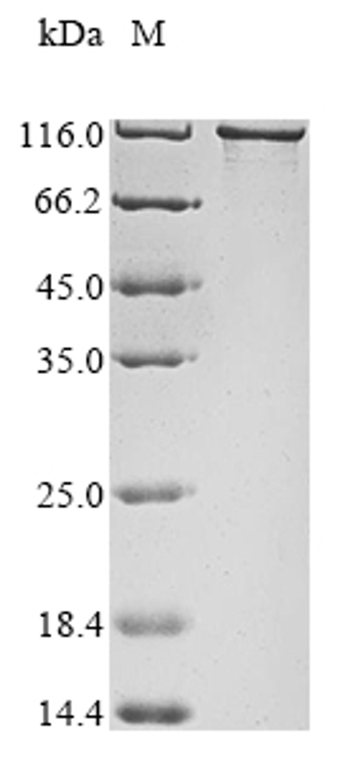 (Tris-Glycine gel) Discontinuous SDS-PAGE (reduced) with 5% enrichment gel and 15% separation gel.