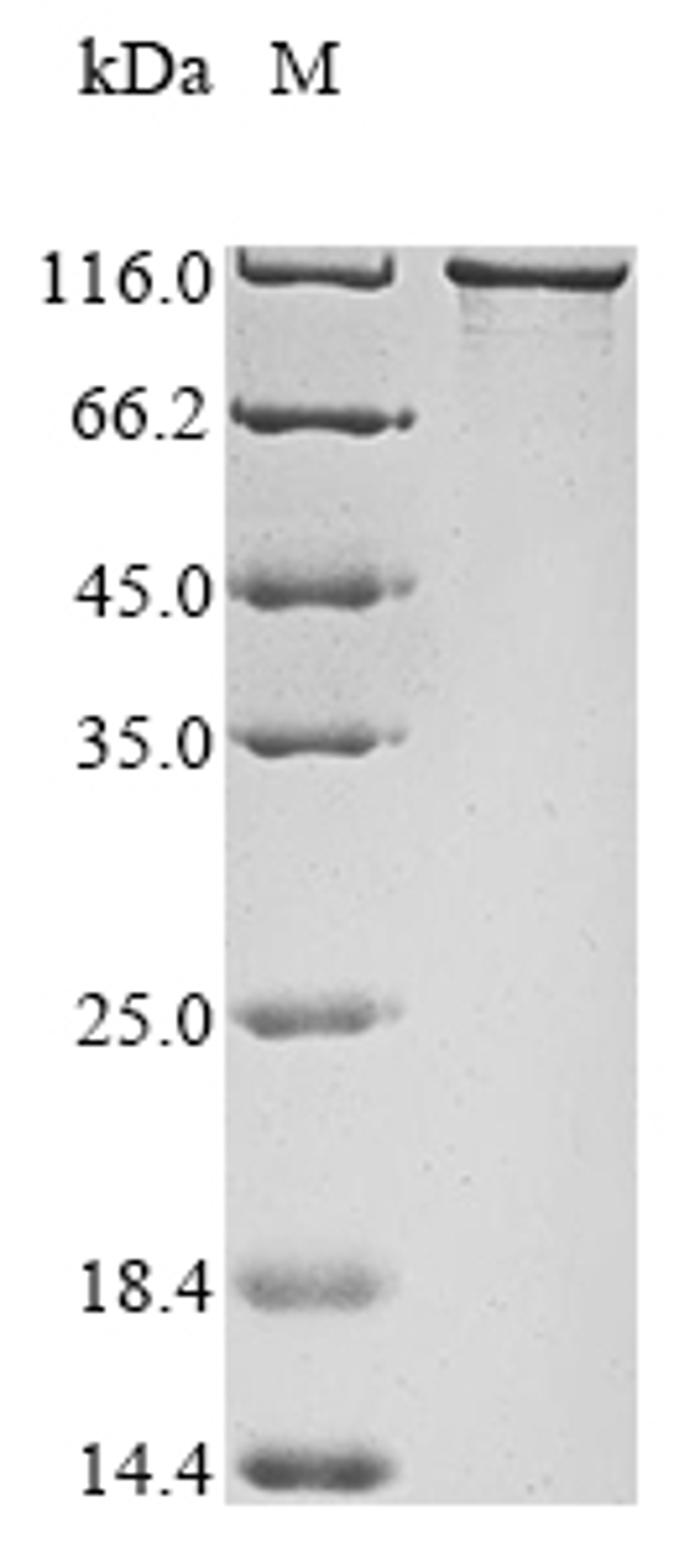 (Tris-Glycine gel) Discontinuous SDS-PAGE (reduced) with 5% enrichment gel and 15% separation gel.