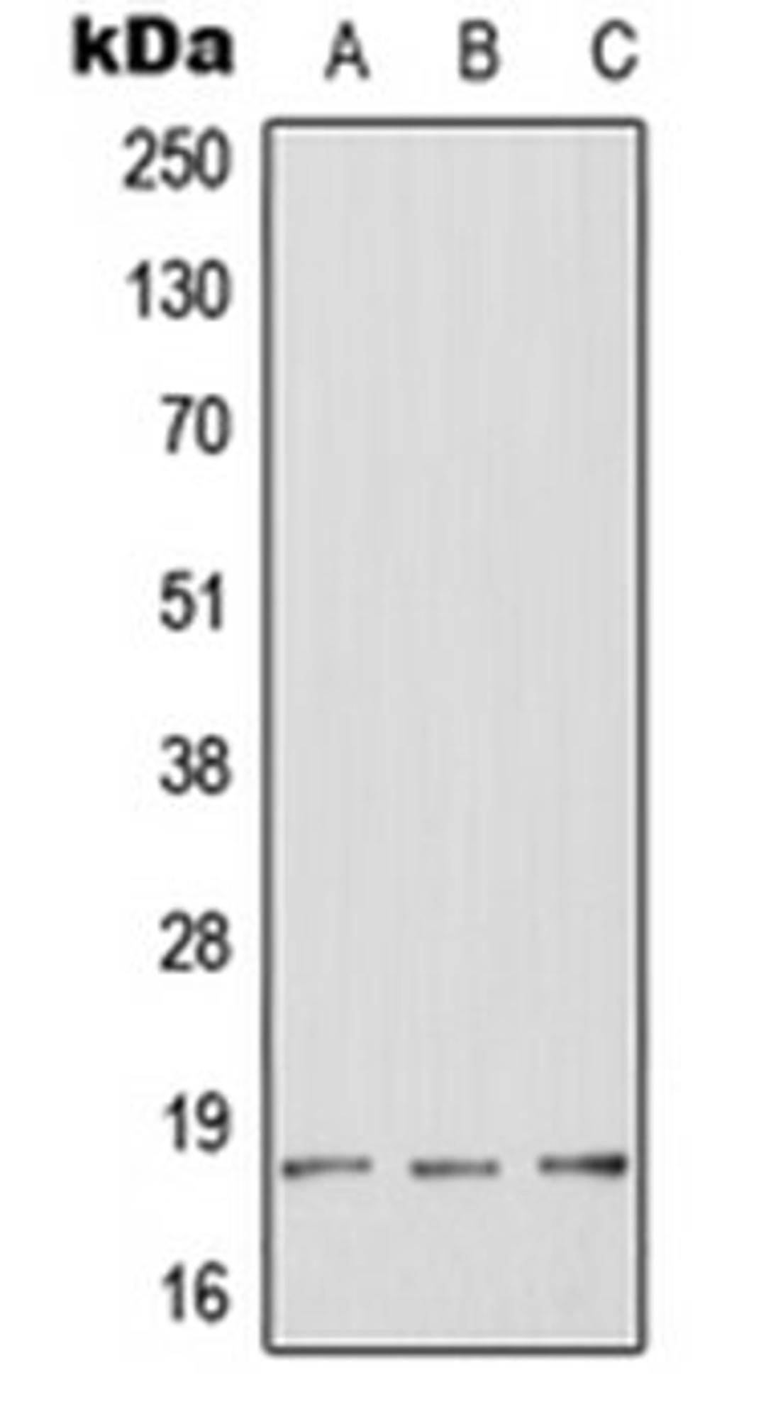 Western blot analysis of HeLa (Lane 1), mouse brain (Lane 2), rat brain (Lane 3) whole cell lysates using HES2 antibody