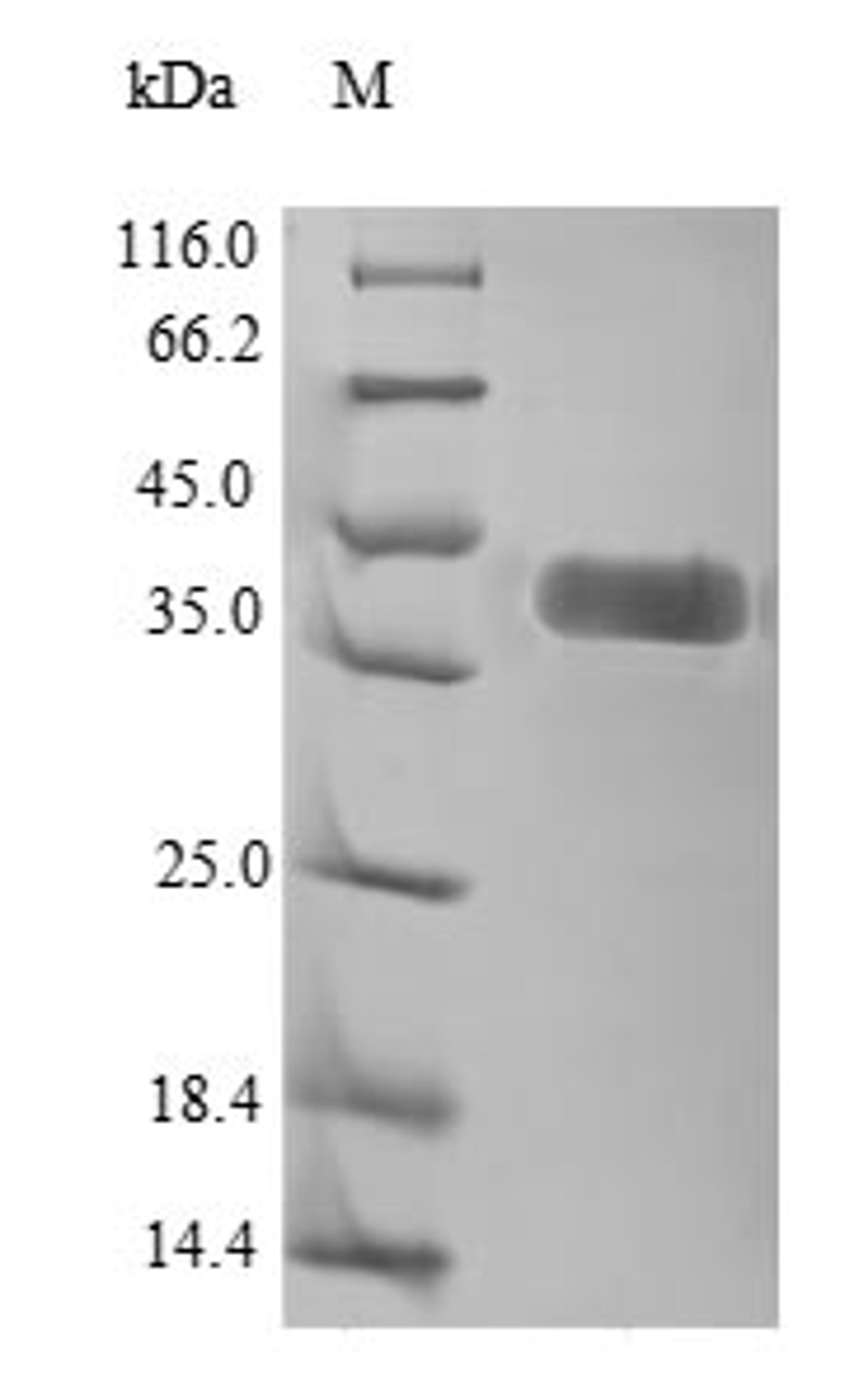 (Tris-Glycine gel) Discontinuous SDS-PAGE (reduced) with 5% enrichment gel and 15% separation gel.