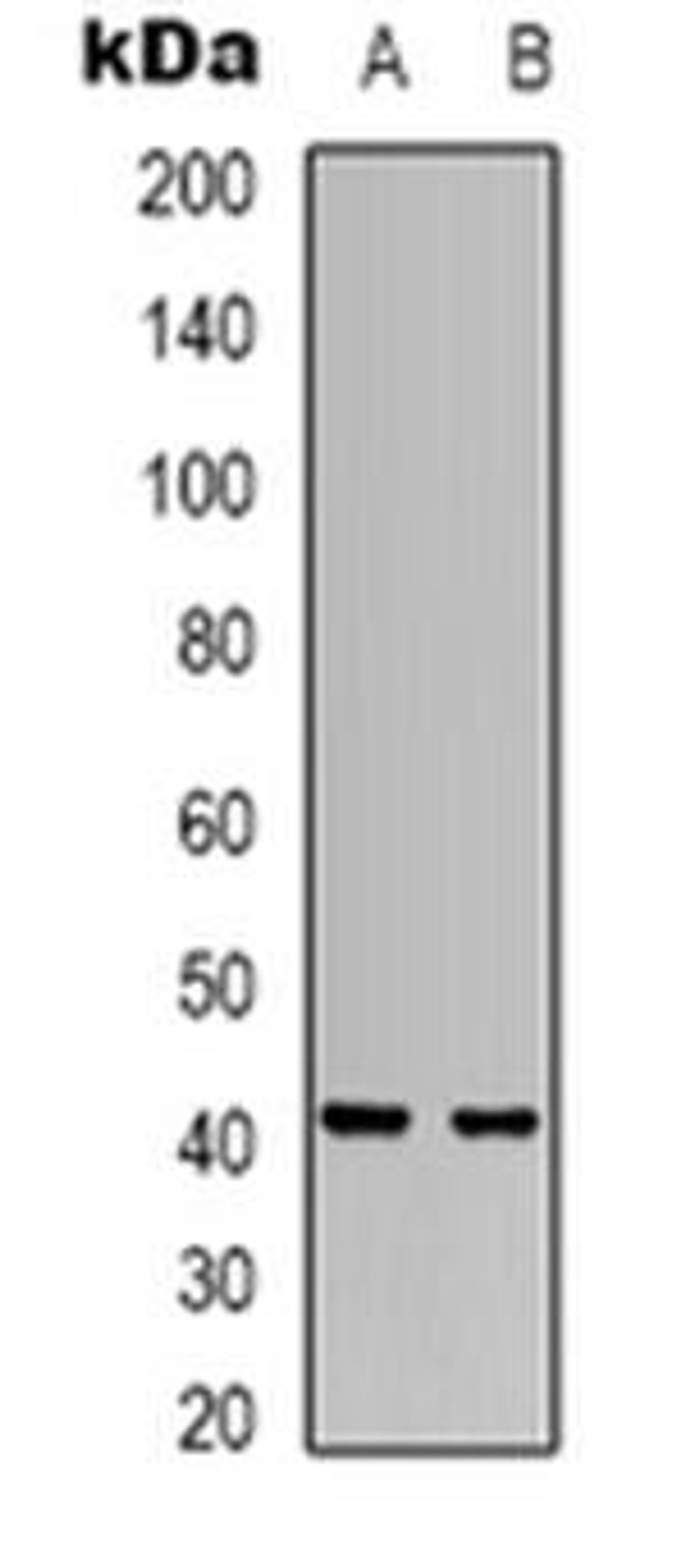 Western blot analysis of RRS1 expression in Hela (Lane 1), SHSY5Y (Lane 2) whole cell lysates using RRS1 antibody