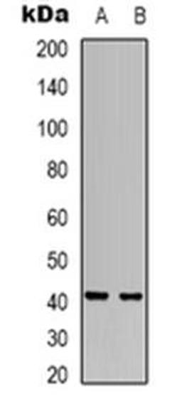 Western blot analysis of RRS1 expression in Hela (Lane 1), SHSY5Y (Lane 2) whole cell lysates using RRS1 antibody