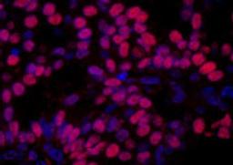 Detection of human HMGN1 by immunohistochemistry.