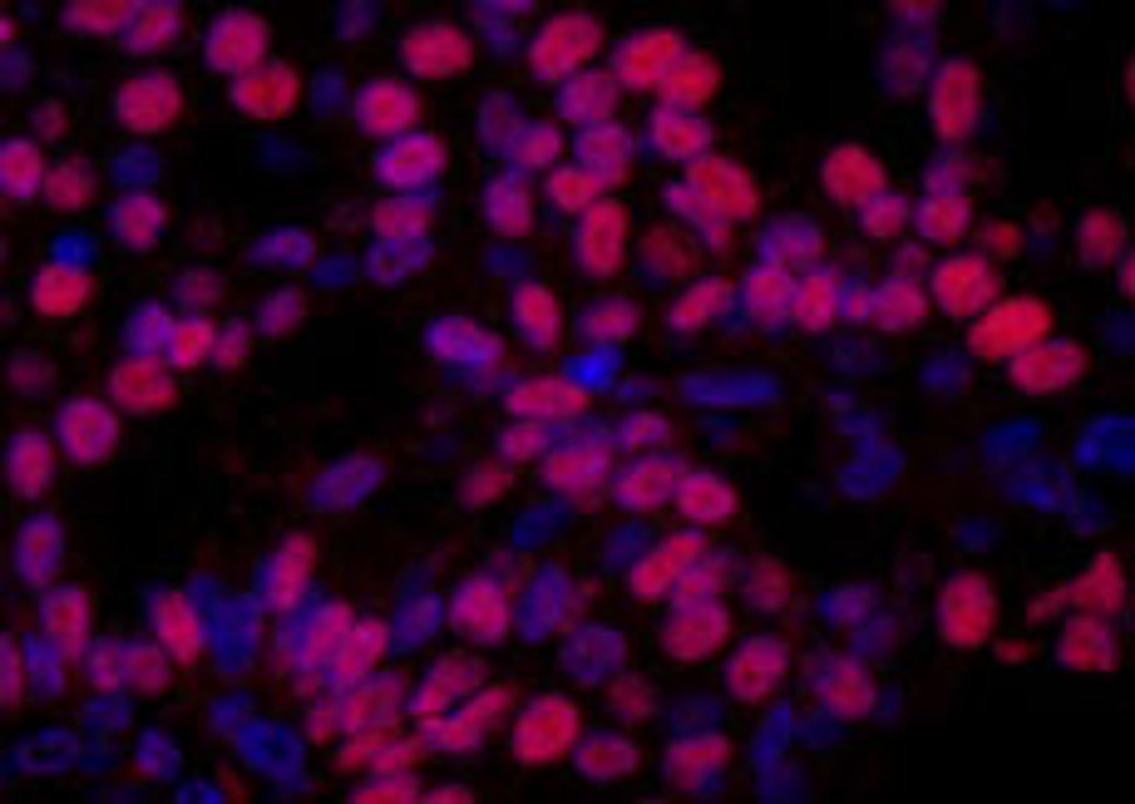 Detection of human HMGN1 by immunohistochemistry.