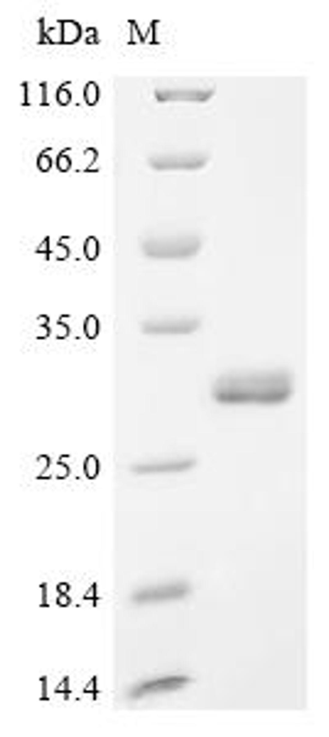 (Tris-Glycine gel) Discontinuous SDS-PAGE (reduced) with 5% enrichment gel and 15% separation gel.