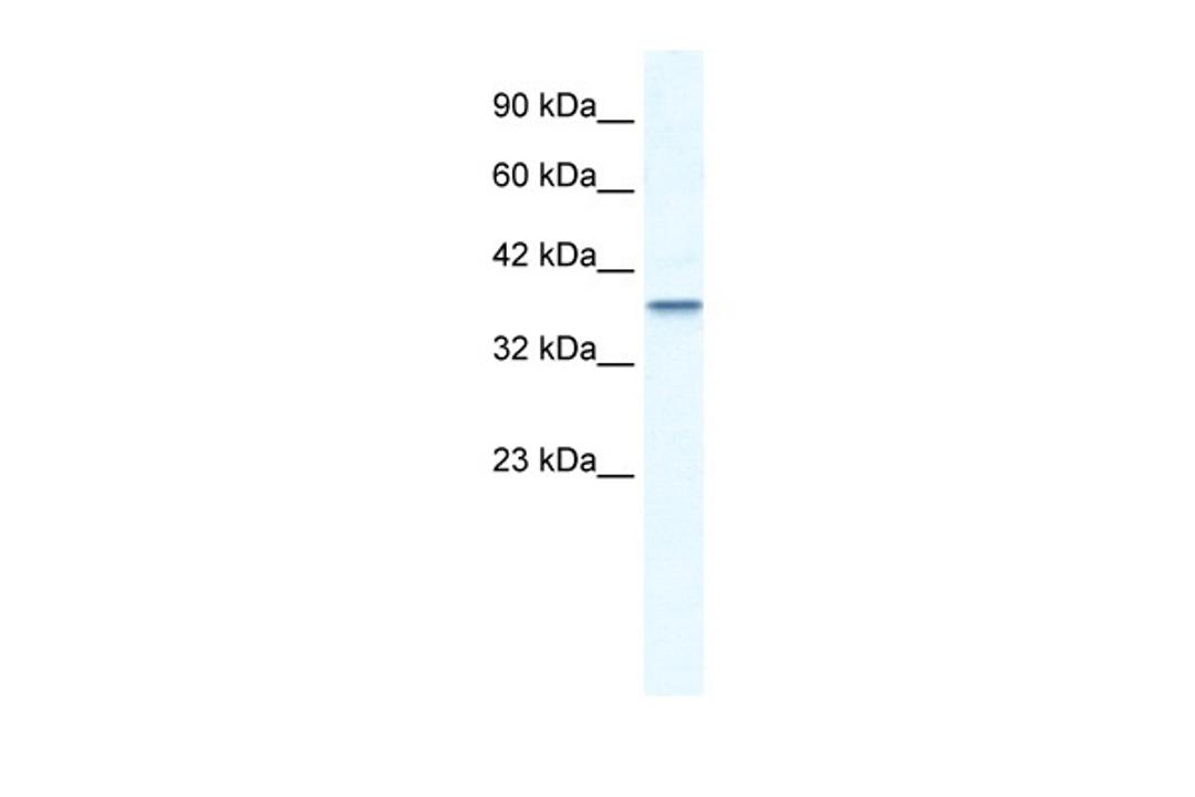 Antibody used in WB on Human Jurkat cells at 2.5 ug/ml.