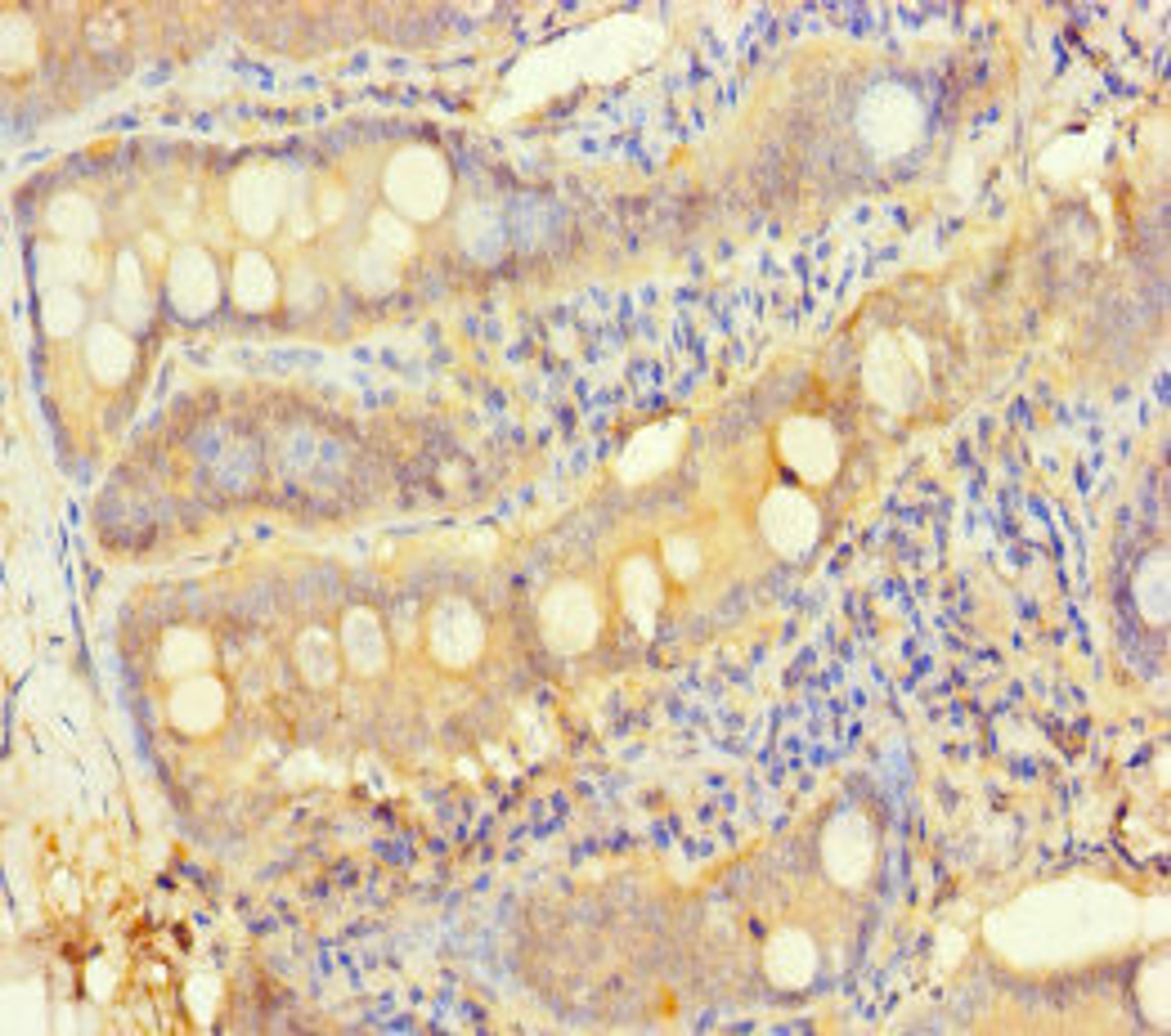 Immunohistochemistry of paraffin-embedded human small intestine tissue using CSB-PA012205LA01HU at dilution of 1:100
