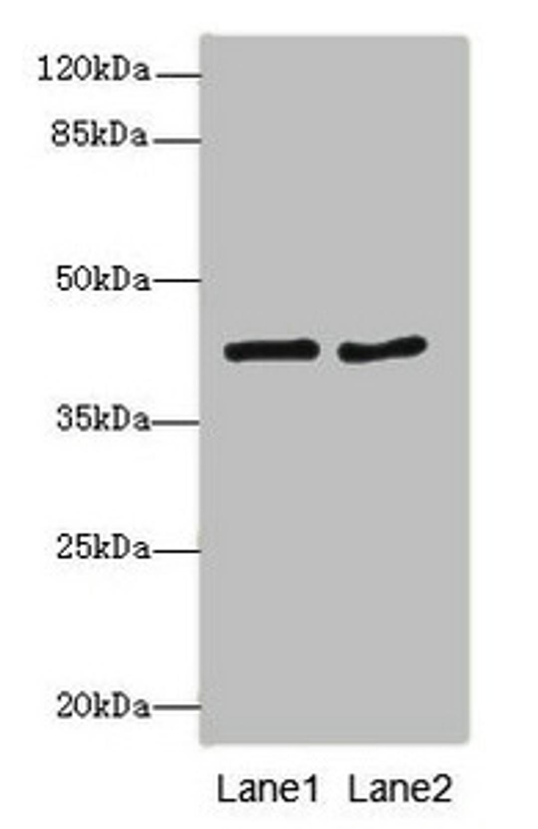 Western blot. All lanes: MTCH1antibody at 2.32ug/ml. Lane 1: MCF-7 whole cell lysate. Lane 2: HepG2 whole cell lysate. Secondary. Goat polyclonal to rabbit IgG at 1/10000 dilution. Predicted band size: 42, 40, 20 kDa. Observed band size: 42 kDa.