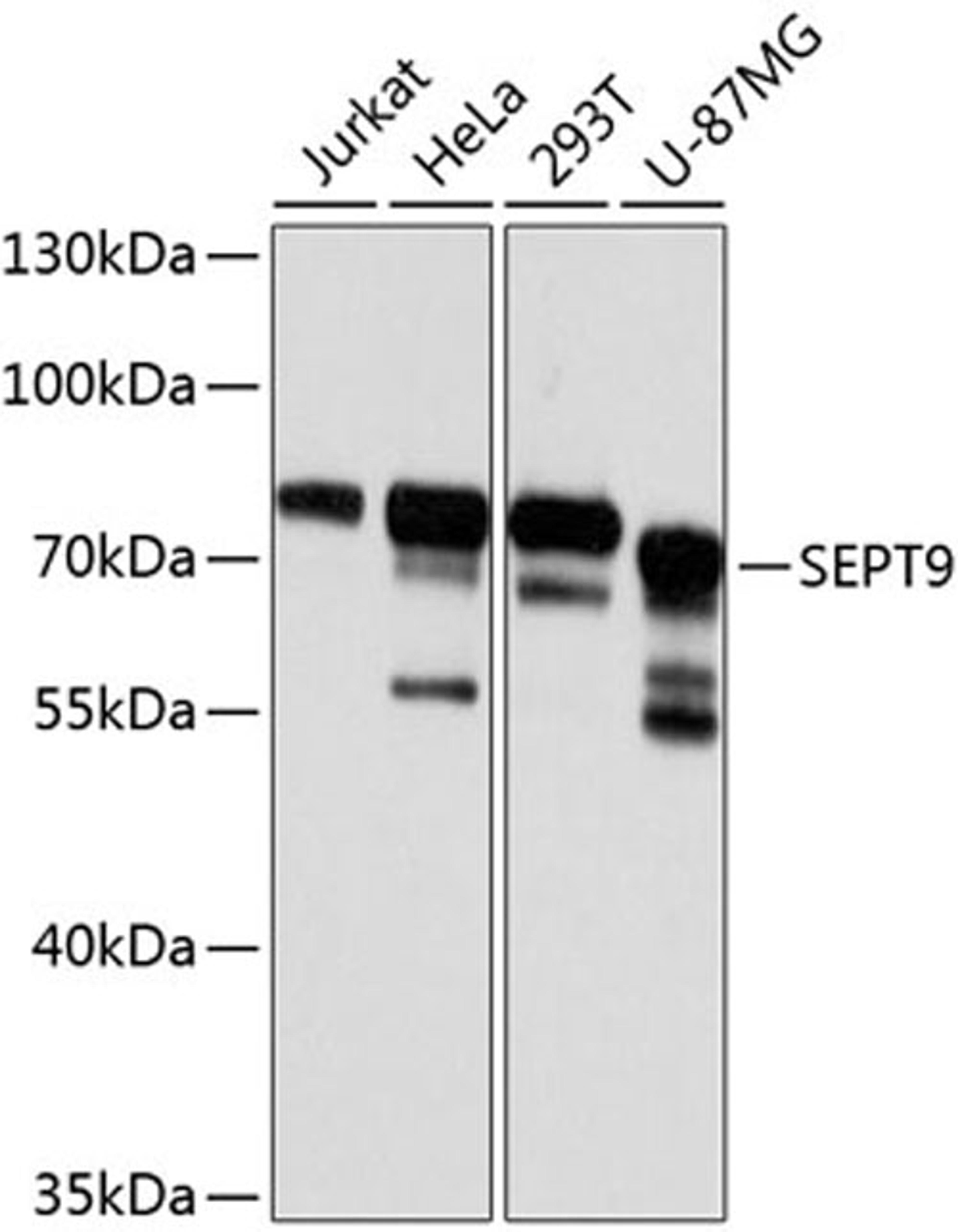 Western blot - SEPT9 antibody (A8657)