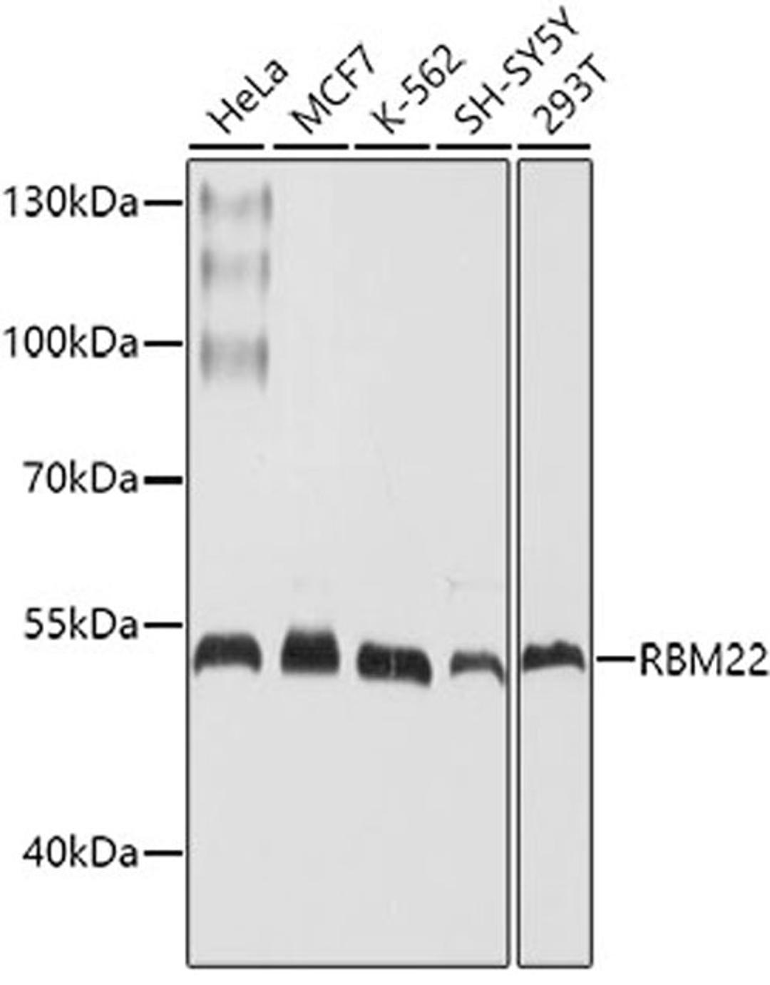 Western blot - RBM22 antibody (A10025)