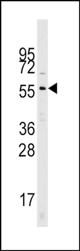 Western blot analysis of Cdc25A Pab in mouse kidney tissue lysates (35ug/lane)