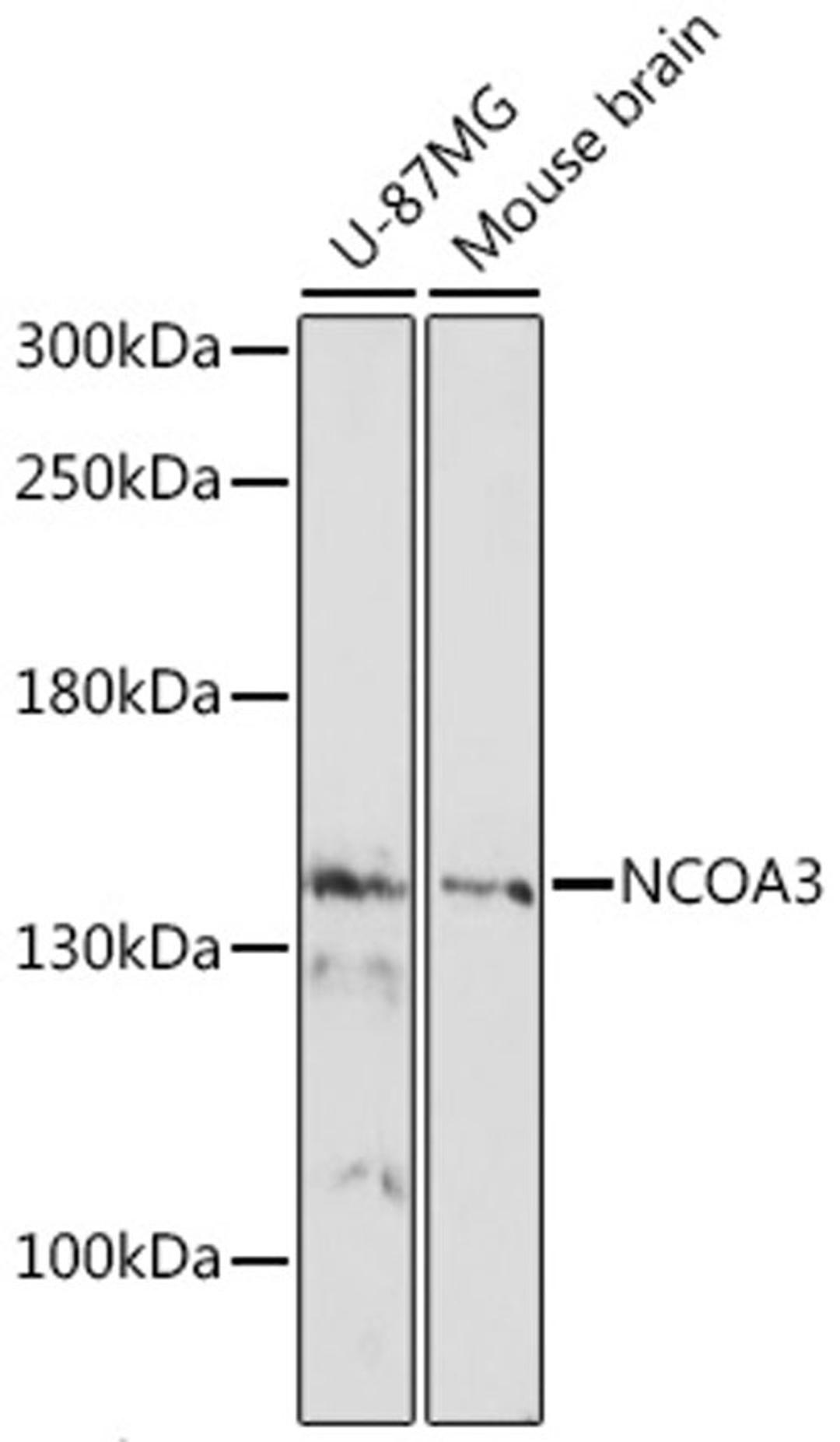 Western blot - NCOA3 antibody (A17330)