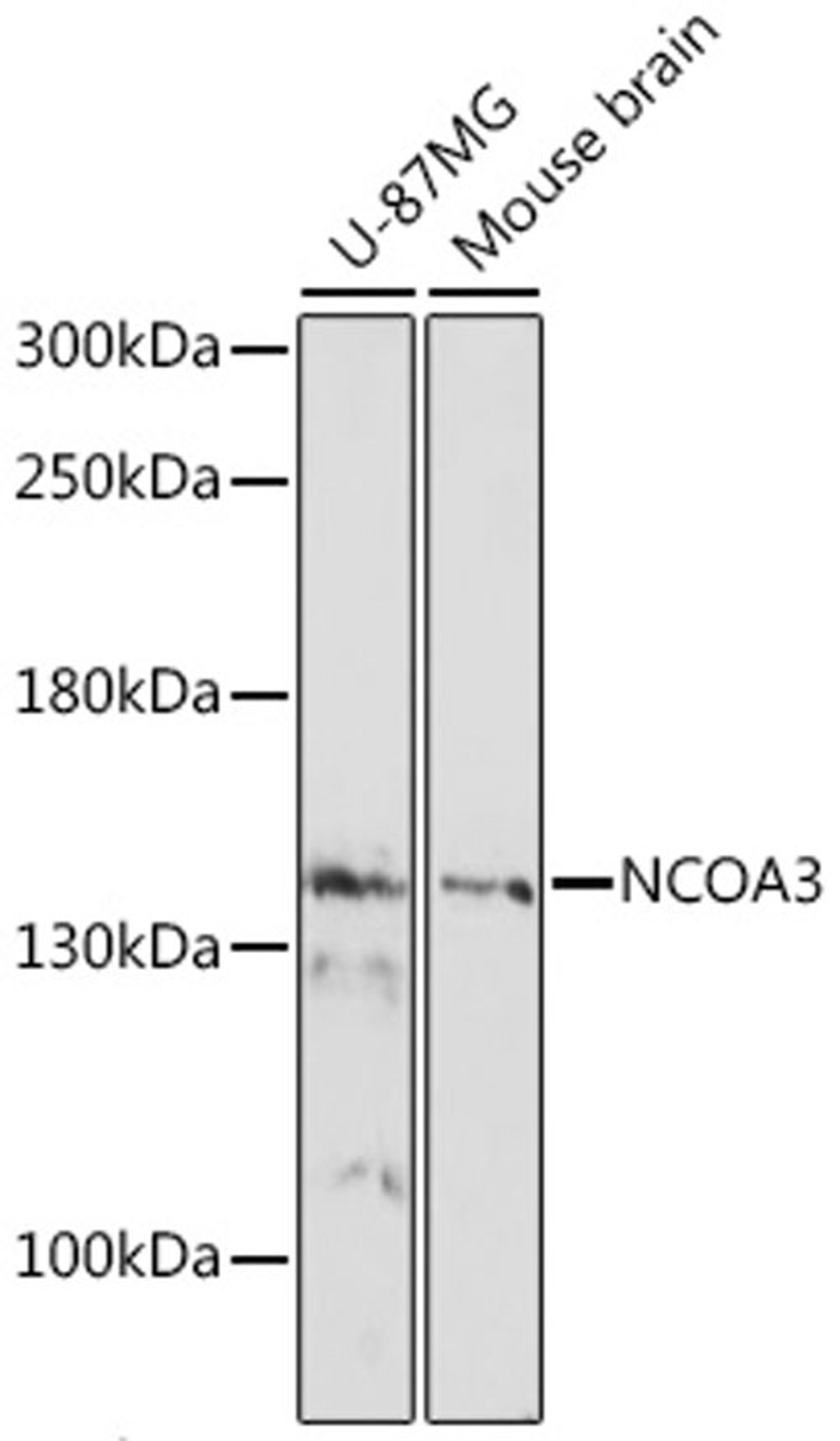 Western blot - NCOA3 antibody (A17330)