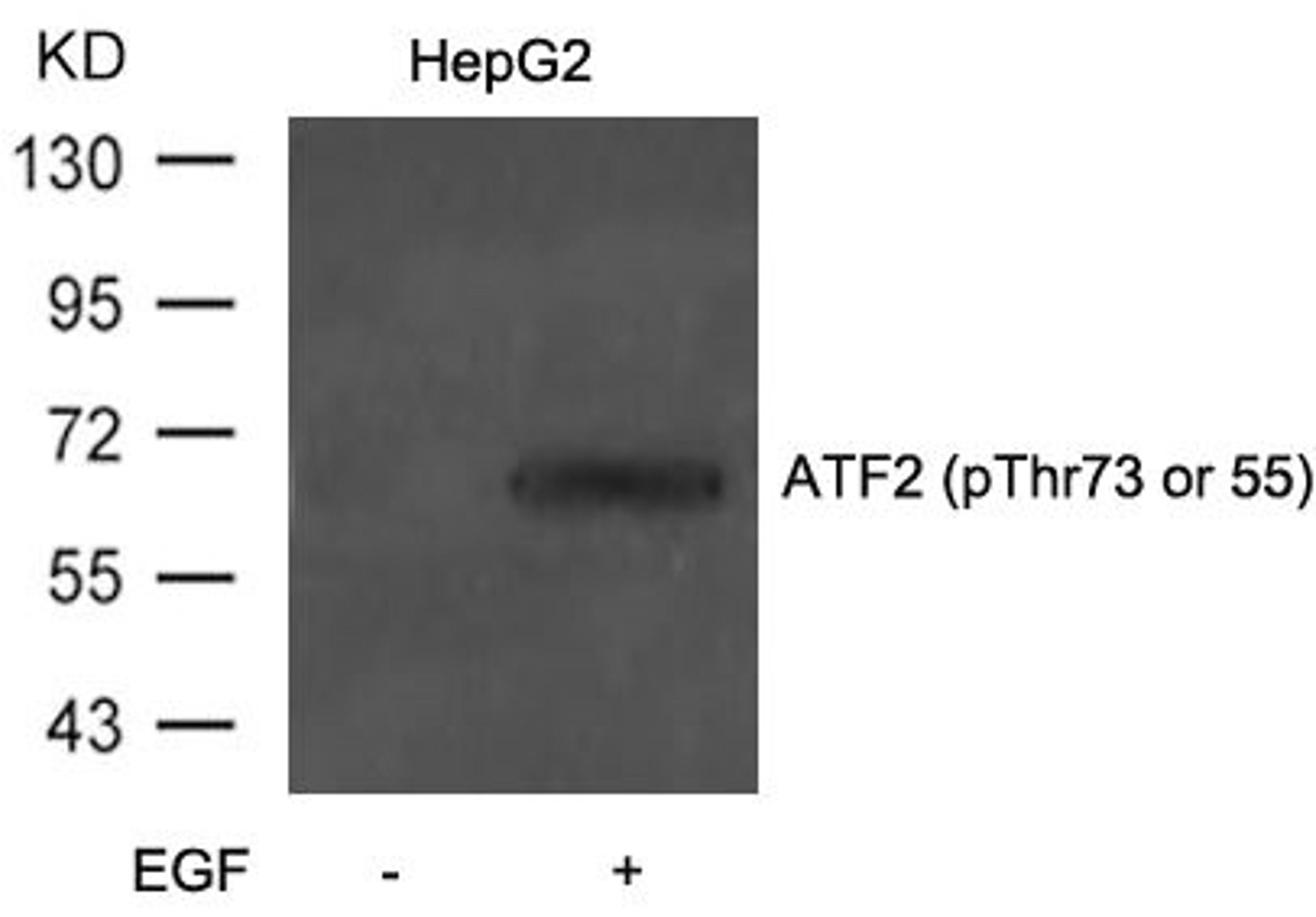 Western blot analysis of extracts from HepG2 cells untreated or treated with EGF using ATF2(Phospho-Thr71 or 53) Antibody.