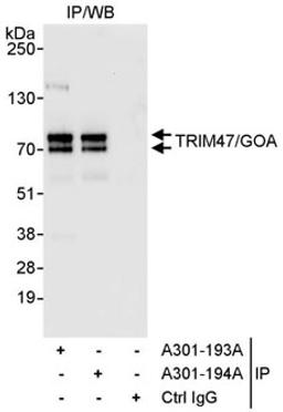 Detection of human TRIM47/GOA by western blot of immunoprecipitates.