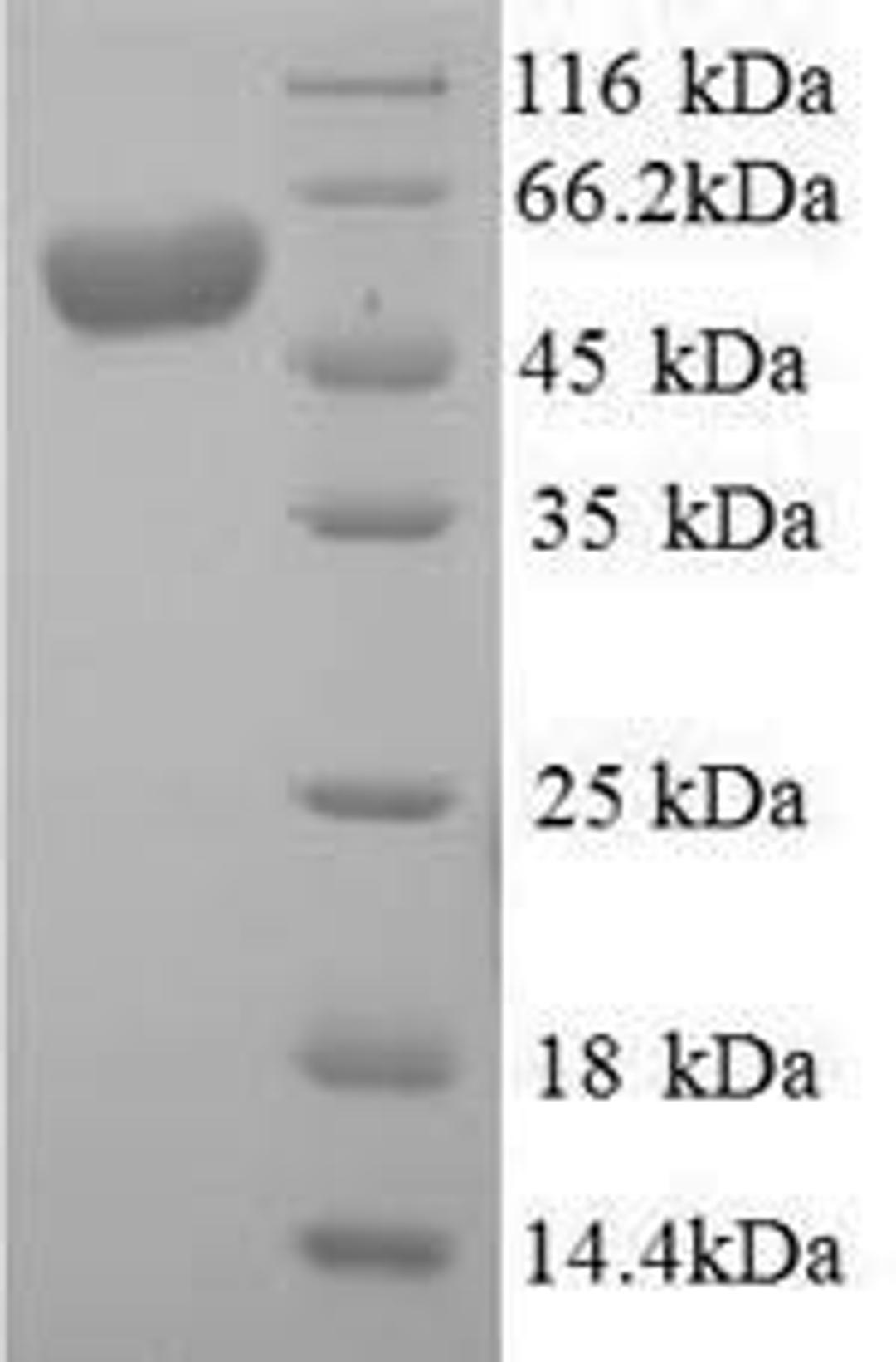 (Tris-Glycine gel) Discontinuous SDS-PAGE (reduced) with 5% enrichment gel and 15% separation gel.