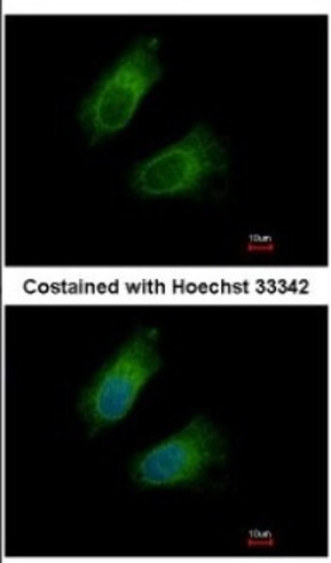 Immunocytochemistry/Immunofluorescence: GOT2 Antibody [NBP2-16708] - Immunofluorescence analysis of methanol-fixed HeLa, using antibody at 1:500 dilution.