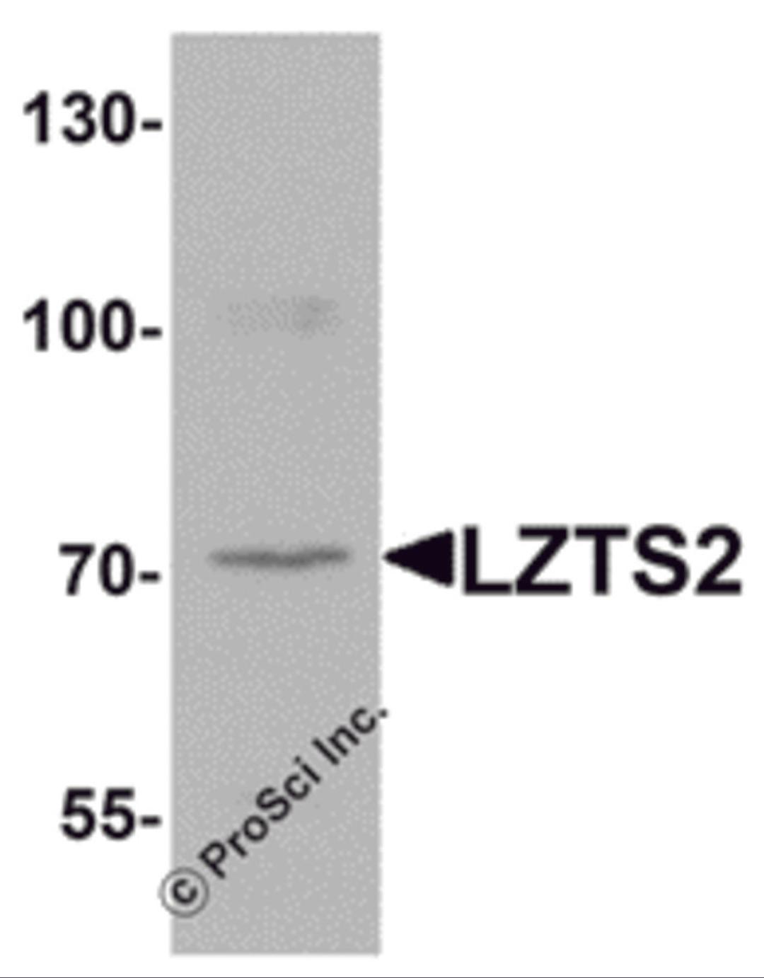 Western blot analysis of LZTS2 in human kidney tissue lysate with LZTS2 antibody at 1 μg/mL.