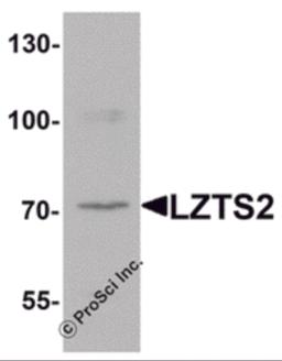 Western blot analysis of LZTS2 in human kidney tissue lysate with LZTS2 antibody at 1 μg/mL.