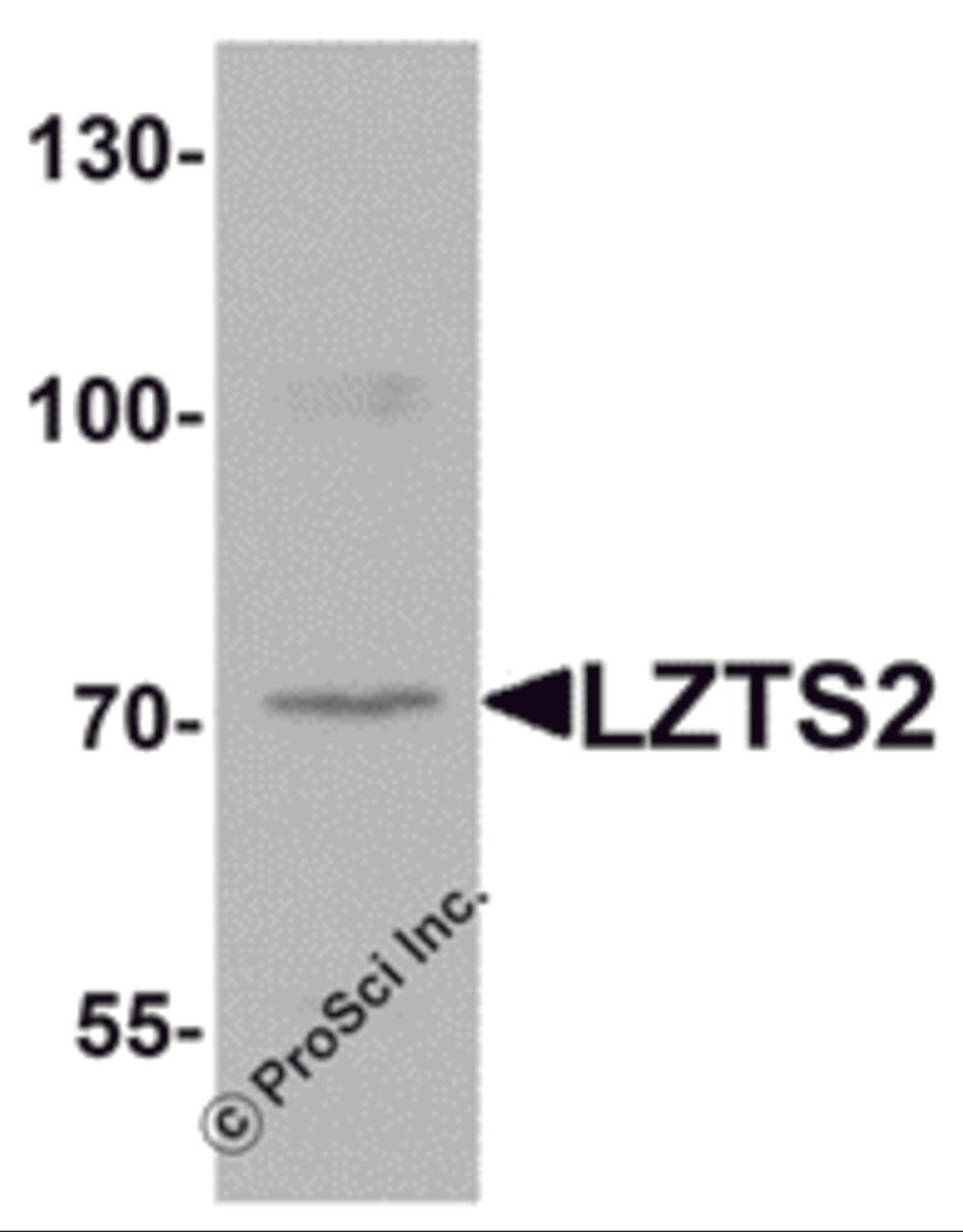 Western blot analysis of LZTS2 in human kidney tissue lysate with LZTS2 antibody at 1 μg/mL.