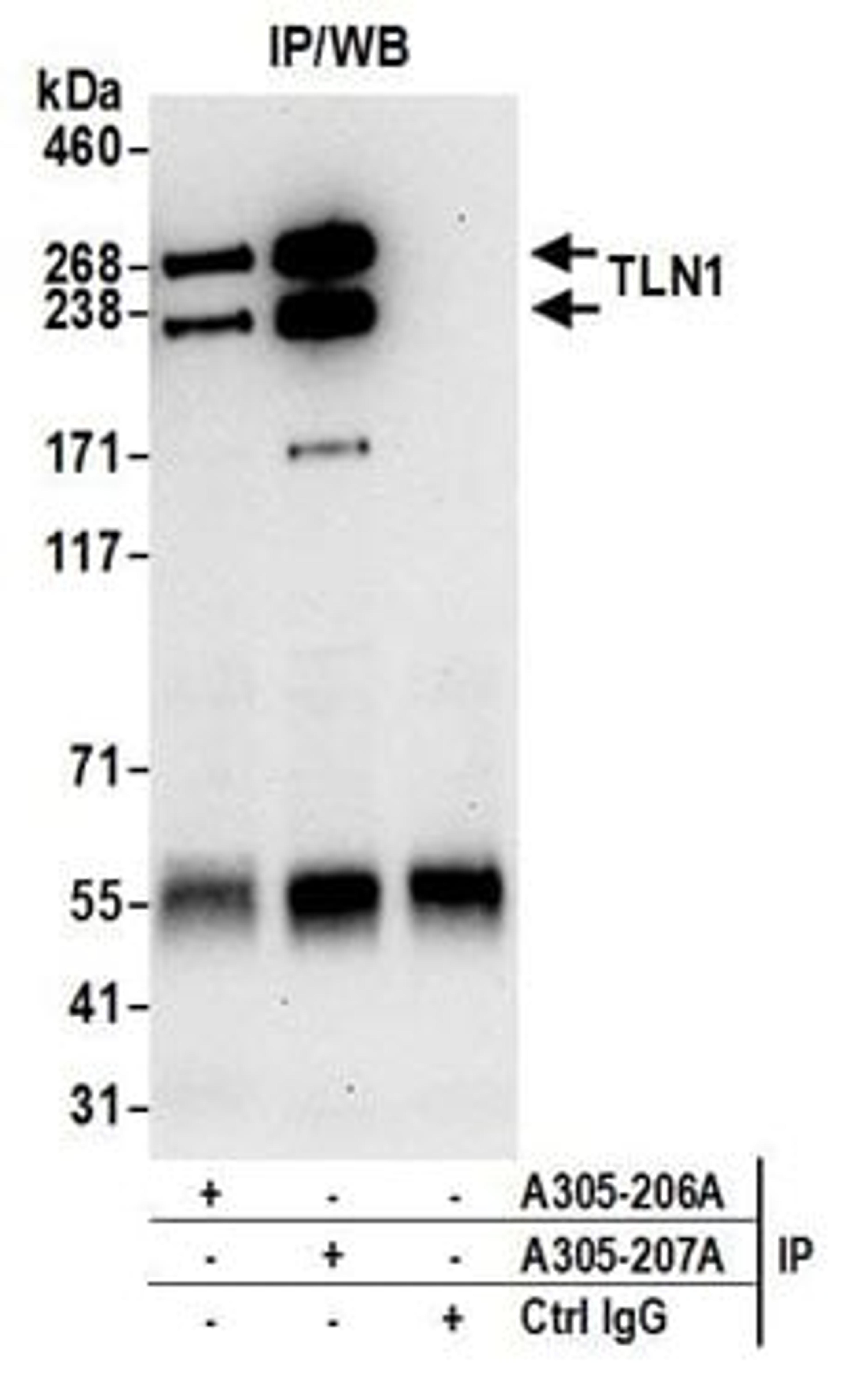 Detection of human TLN1 by western blot of immunoprecipitates.