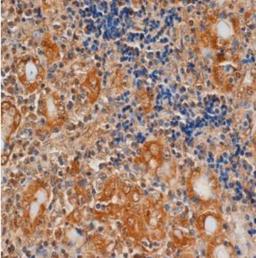 Immunohistochemistry-Paraffin: TSH R Antibody (4C1) [NB100-65797] - Human thyroid.