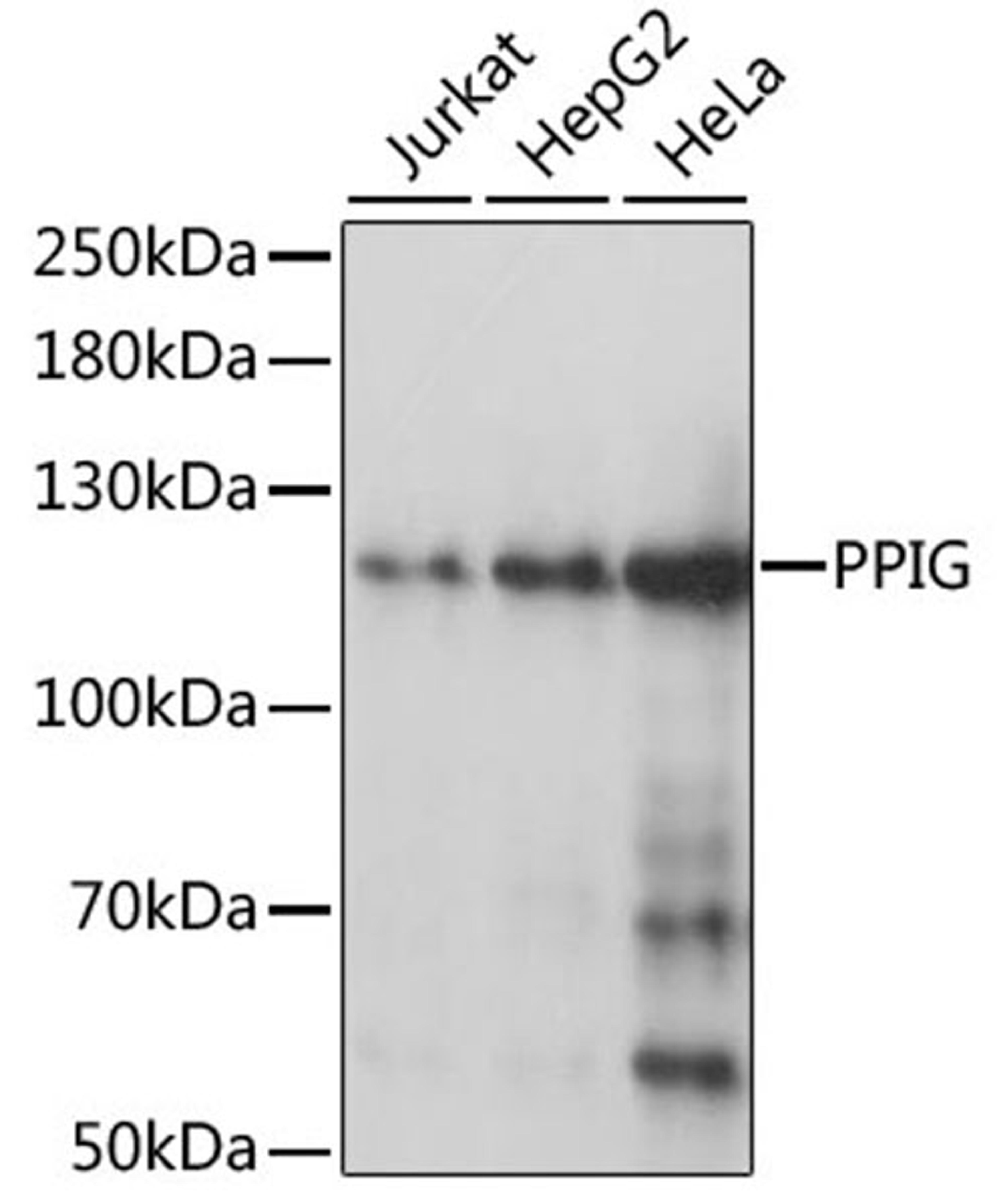 Western blot - PPIG antibody (A0429)