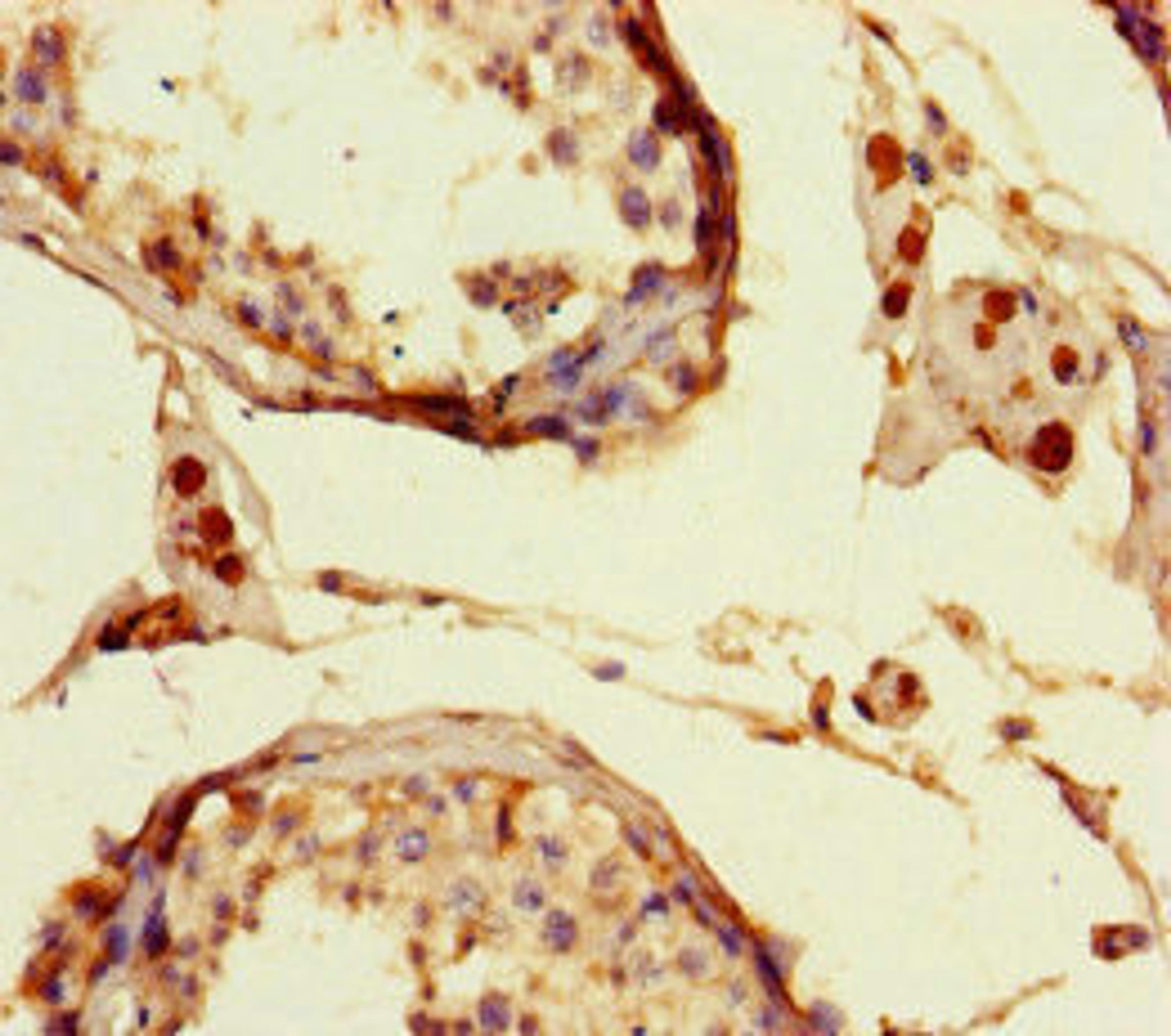 Immunohistochemistry of paraffin-embedded human testis tissue using CSB-PA012931LA01HU at dilution of 1:100