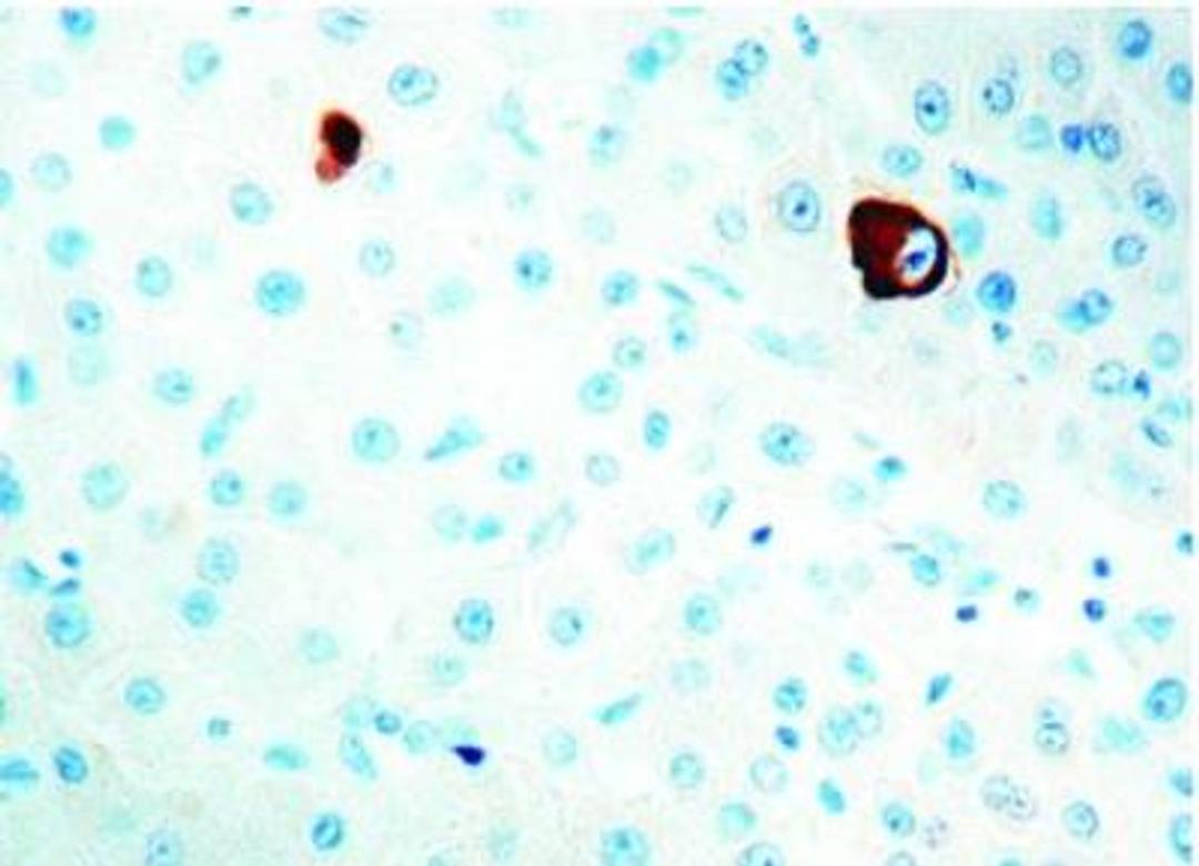 Immunohistochemistry-Paraffin: HBsAg Antibody (3E7) [NBP1-22568] - Human liver.