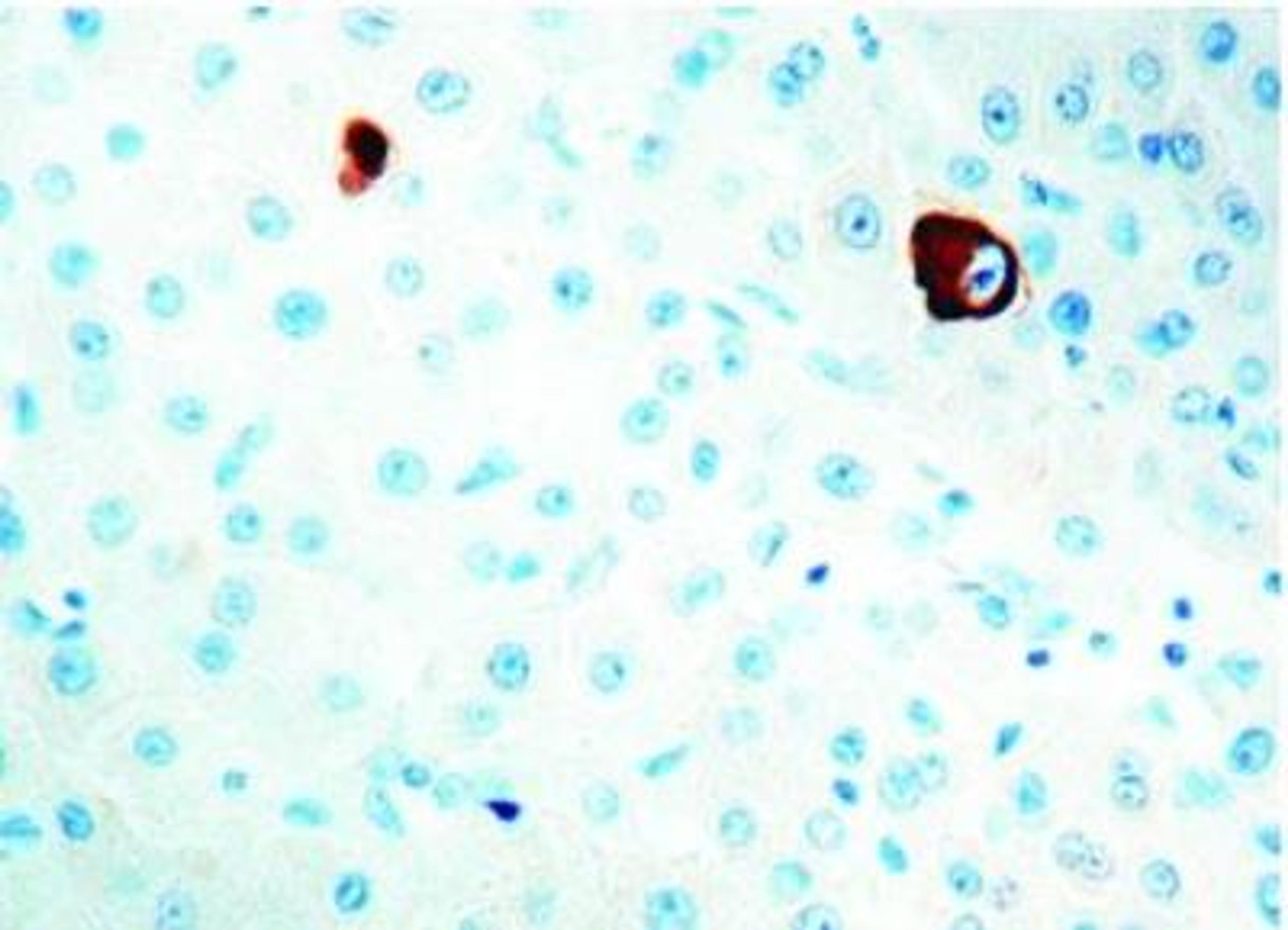 Immunohistochemistry-Paraffin: HBsAg Antibody (3E7) [NBP1-22568] - Human liver.