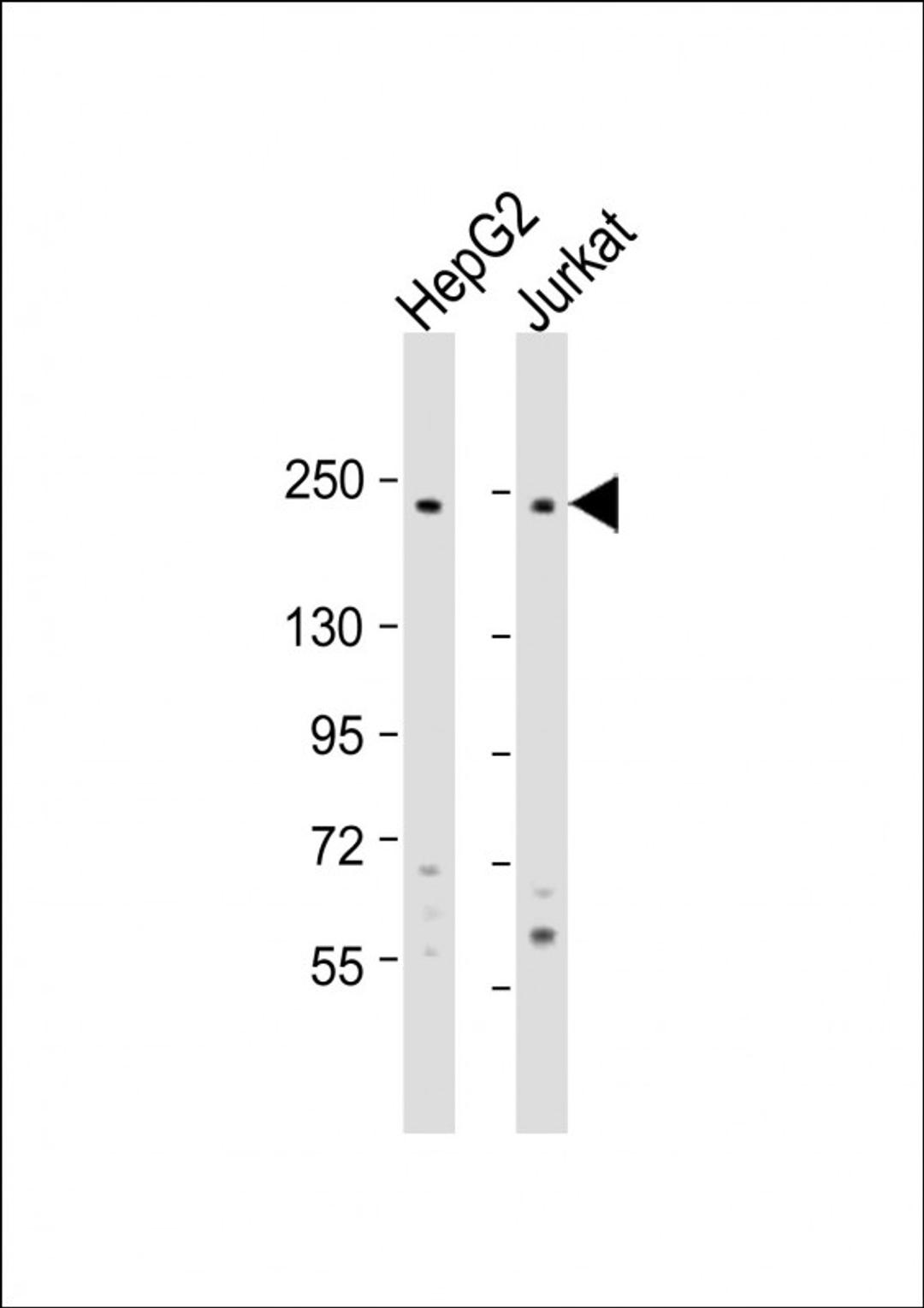 Western Blot at 1:1000 dilution Lane 1: HepG2 whole cell lysate Lane 2: Jurkat whole cell lysate Lysates/proteins at 20 ug per lane.