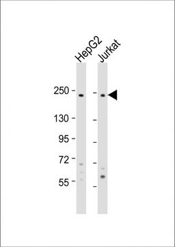 Western Blot at 1:1000 dilution Lane 1: HepG2 whole cell lysate Lane 2: Jurkat whole cell lysate Lysates/proteins at 20 ug per lane.