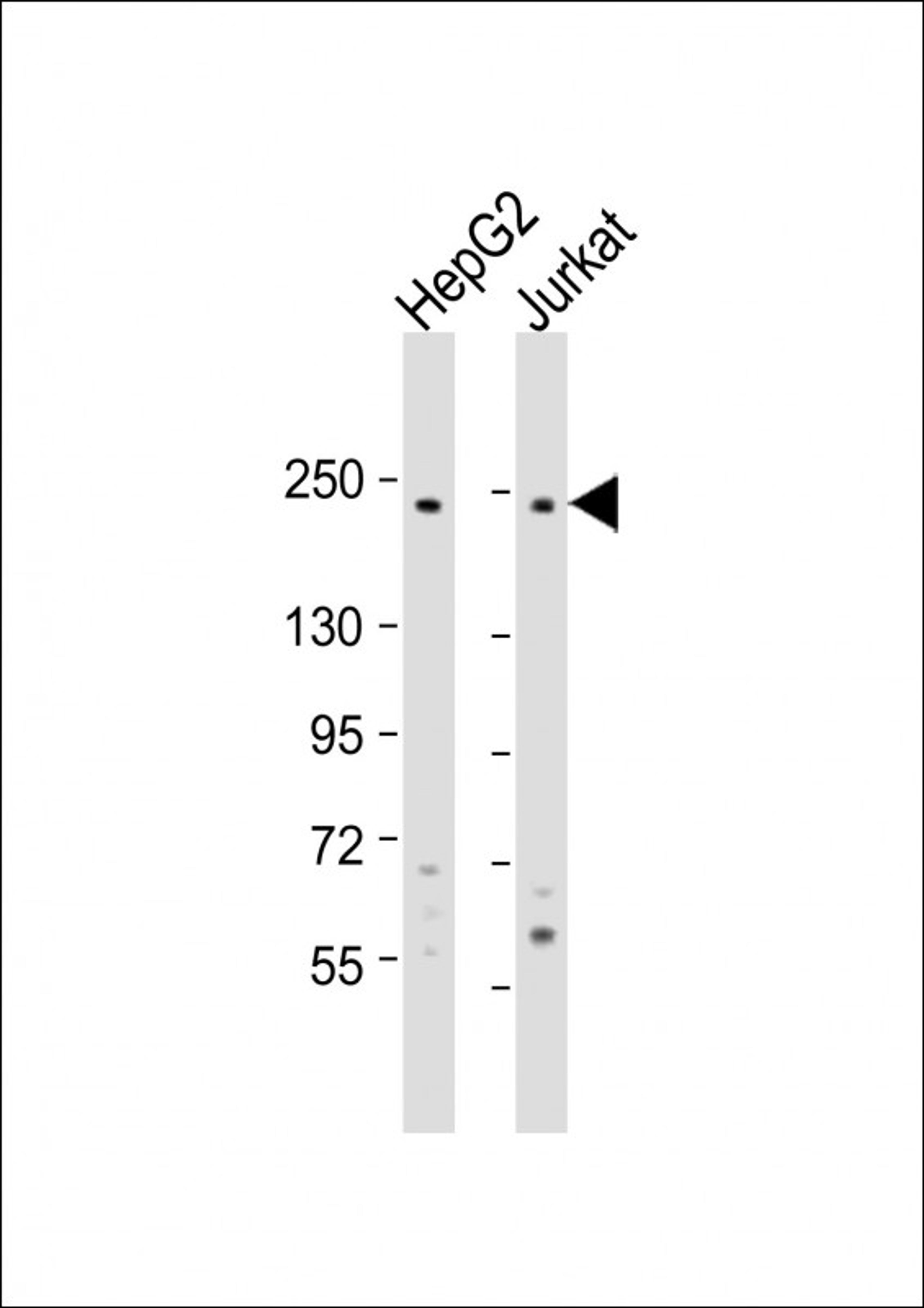 Western Blot at 1:1000 dilution Lane 1: HepG2 whole cell lysate Lane 2: Jurkat whole cell lysate Lysates/proteins at 20 ug per lane.