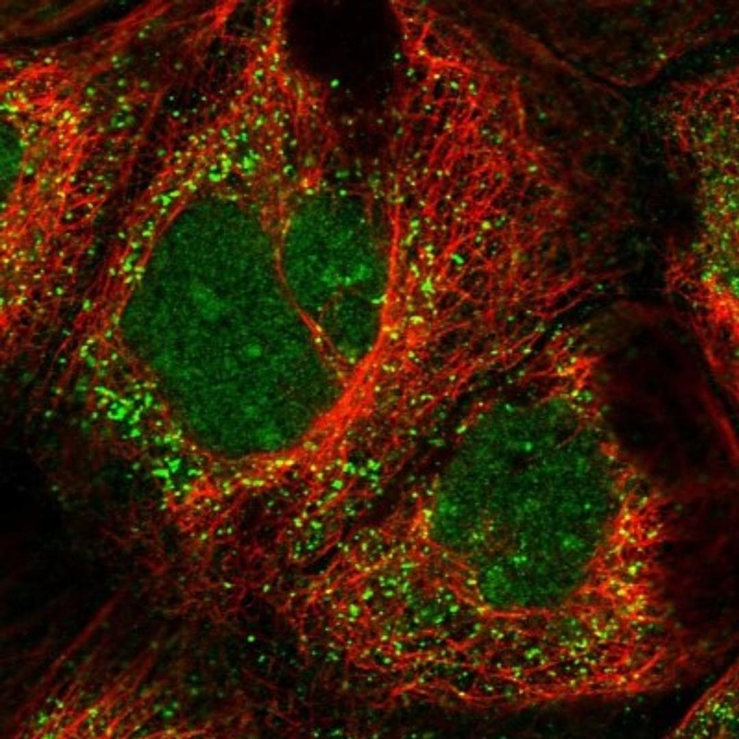 Immunocytochemistry/Immunofluorescence: EXOC3L2 Antibody [NBP1-93817] - Staining of human cell line A-431 shows positivity in nucleus, nucleoli & vesicles.