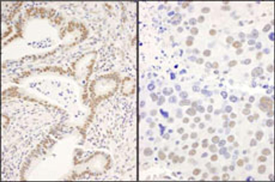 Detection of human and mouse CCAR1 by immunohistochemistry.