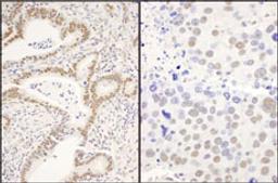 Detection of human and mouse CCAR1 by immunohistochemistry.