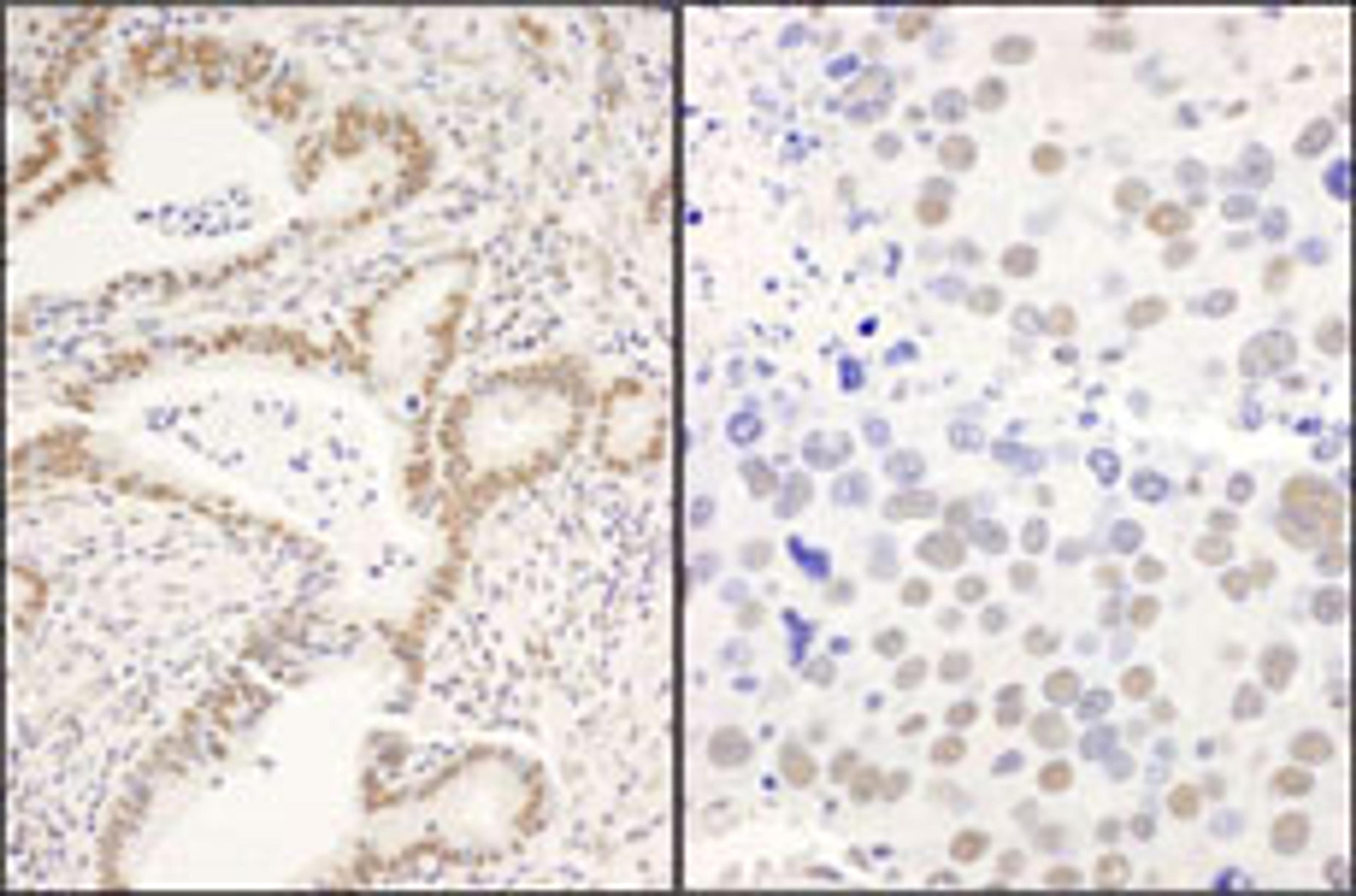 Detection of human and mouse CCAR1 by immunohistochemistry.