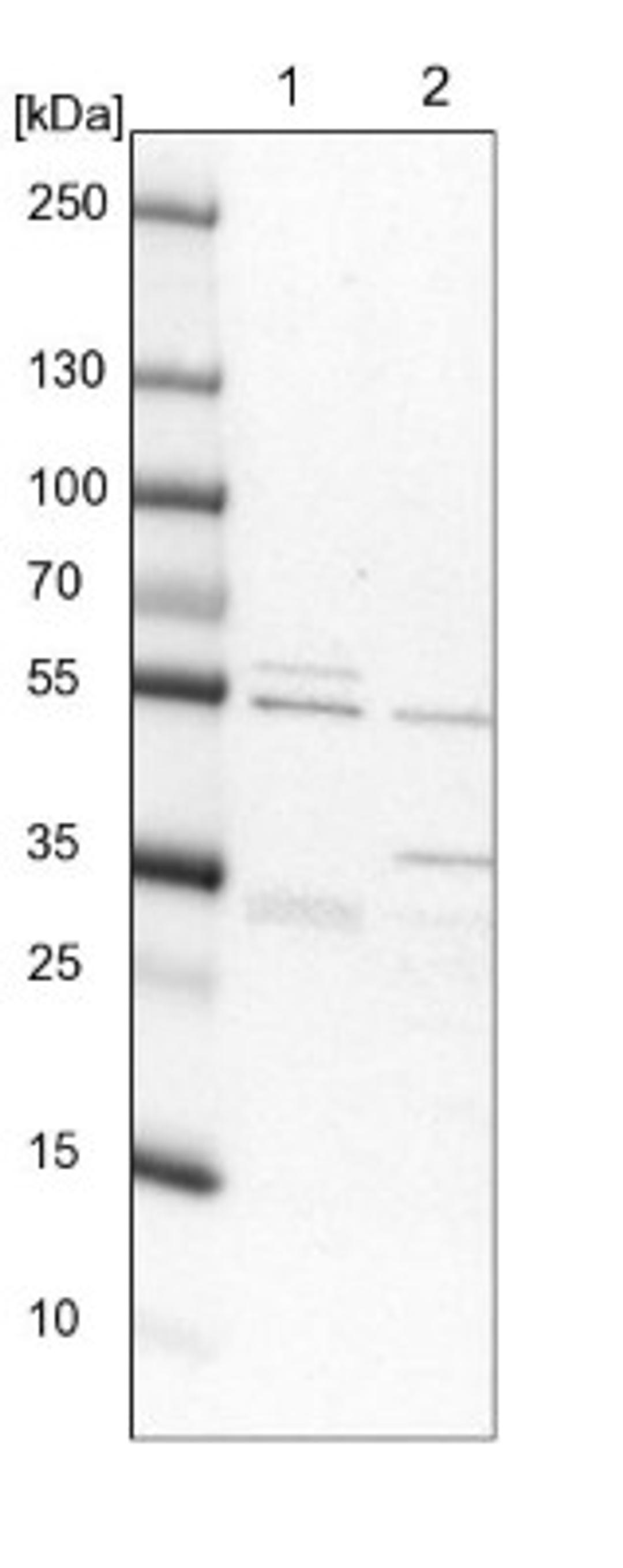 Western Blot: RMND5A Antibody [NBP1-92337] - Lane 1: NIH-3T3 cell lysate (Mouse embryonic fibroblast cells)<br/>Lane 2: NBT-II cell lysate (Rat Wistar bladder tumour cells)