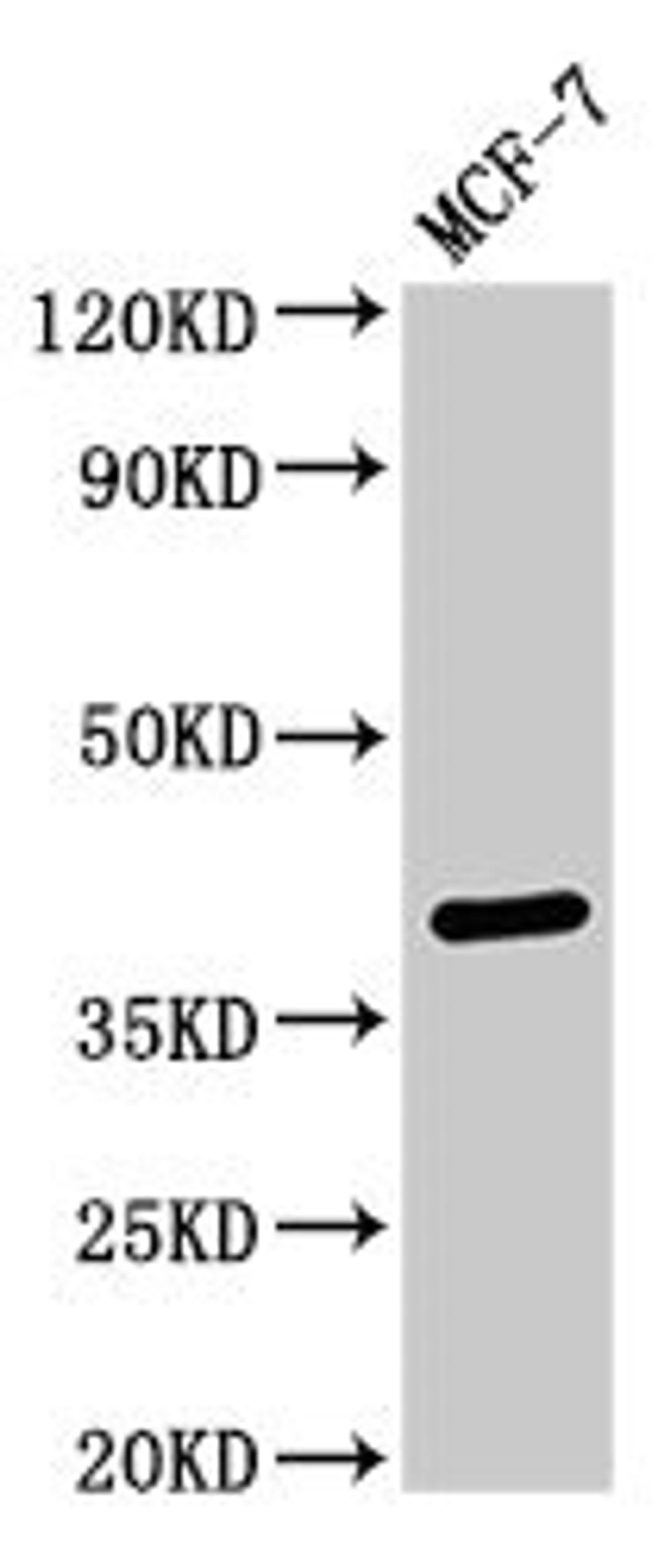Western Blot. Positive WB detected in: MCF-7 whole cell lysate. All lanes: SFRP4 antibody at 3ug/ml. Secondary. Goat polyclonal to rabbit IgG at 1/50000 dilution. Predicted band size: 40 kDa. Observed band size: 40 kDa. 