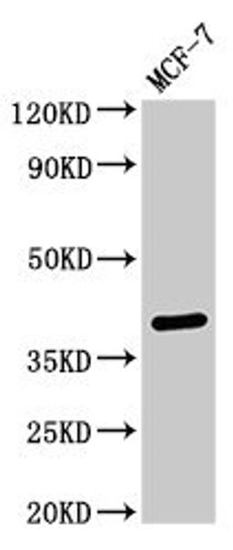 Western Blot. Positive WB detected in: MCF-7 whole cell lysate. All lanes: SFRP4 antibody at 3ug/ml. Secondary. Goat polyclonal to rabbit IgG at 1/50000 dilution. Predicted band size: 40 kDa. Observed band size: 40 kDa. 