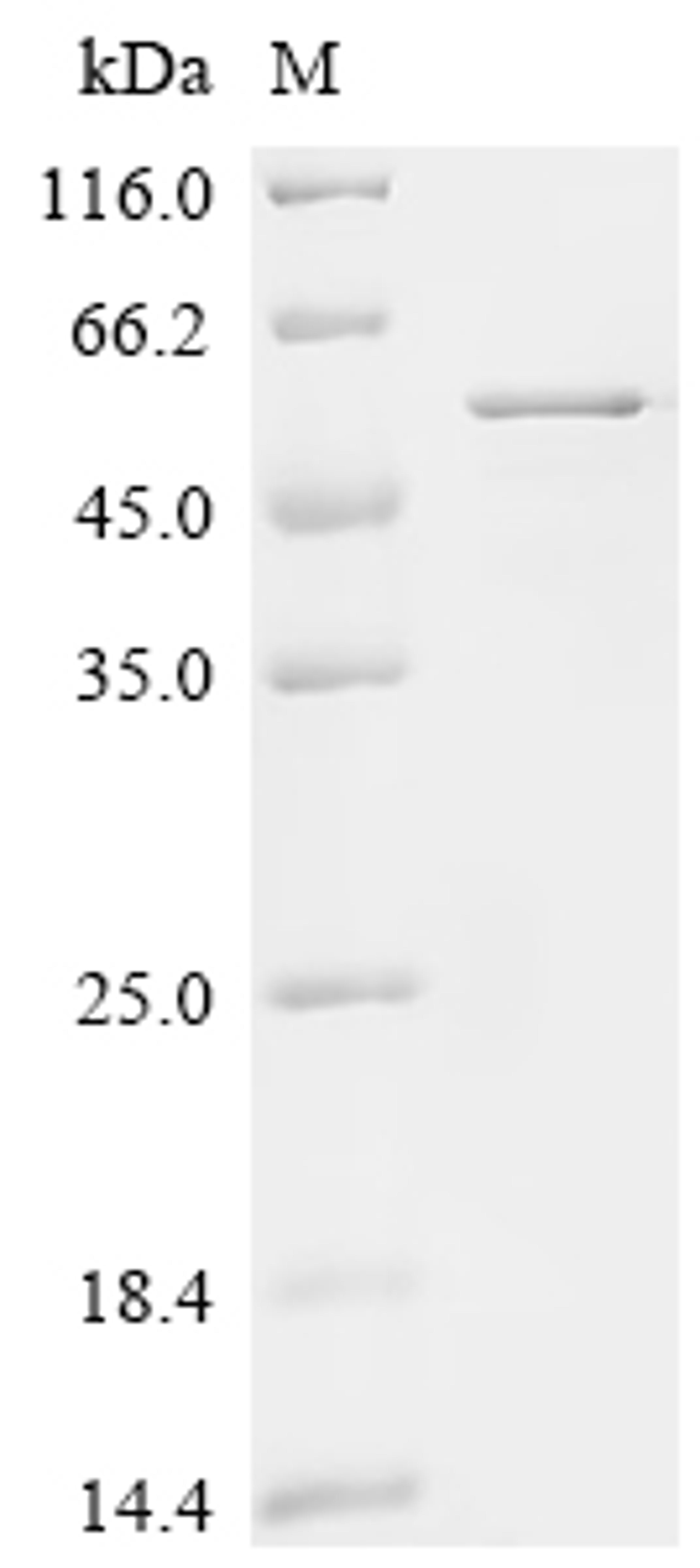 (Tris-Glycine gel) Discontinuous SDS-PAGE (reduced) with 5% enrichment gel and 15% separation gel.