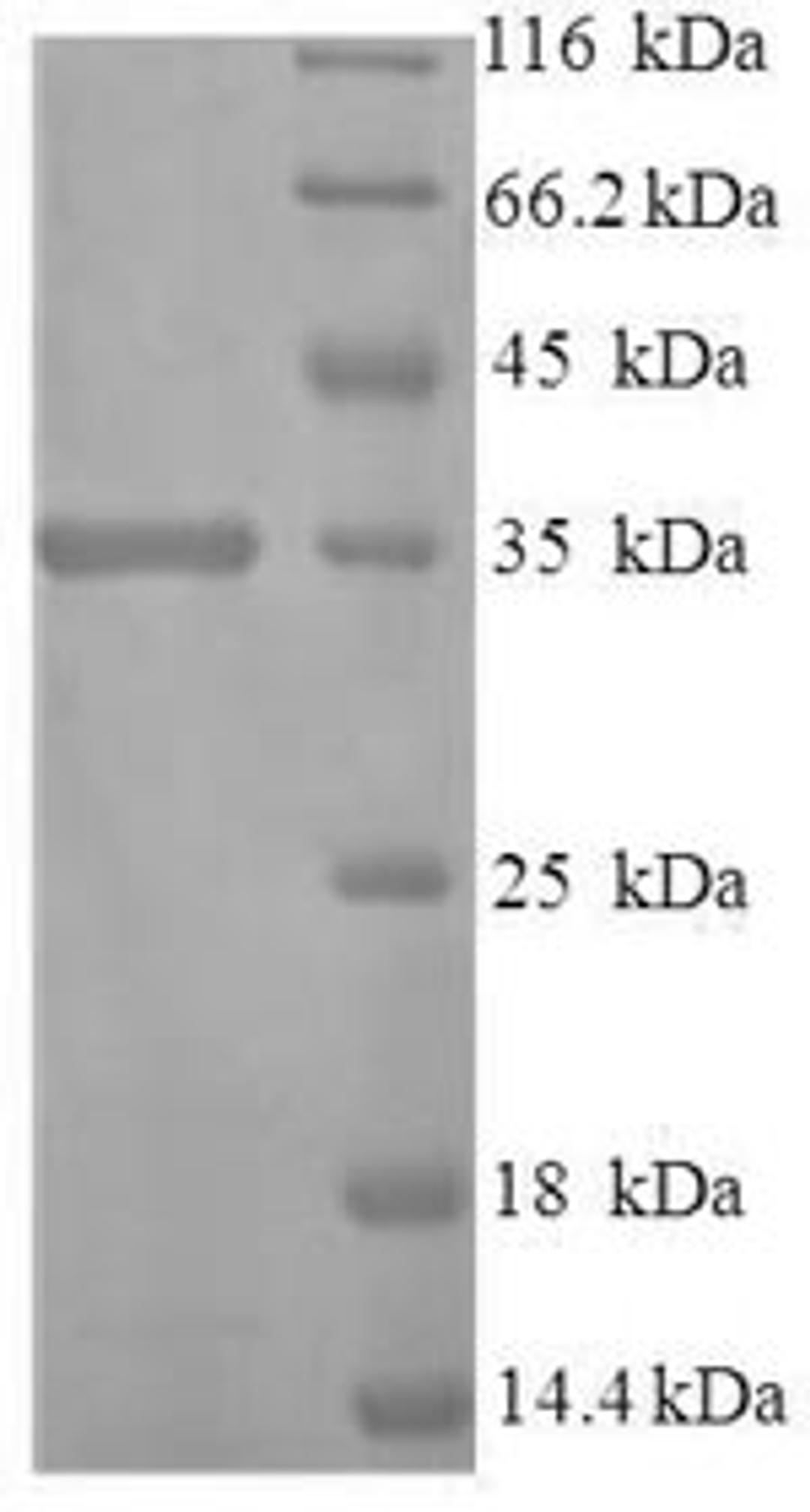 (Tris-Glycine gel) Discontinuous SDS-PAGE (reduced) with 5% enrichment gel and 15% separation gel.