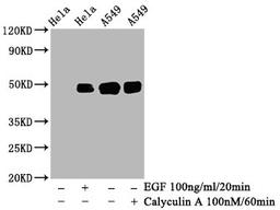 Western Blot. Positive WB detected in: Hela whole cell lysate, A549 whole cell lysate(treated with Calyculin A or EGF). All lanes: Phospho-JUN antibody at 0.95μg/ml. Secondary. Goat polyclonal to rabbit IgG at 1/50000 dilution. Predicted band size: 48 KDa. Observed band size: 48 KDa