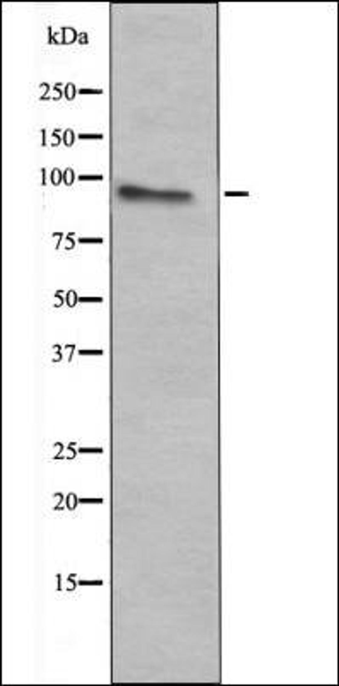 Western blot analysis of HeLa whole cell lysates using c-Fes -Phospho-Tyr713- antibody