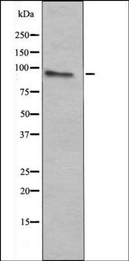 Western blot analysis of HeLa whole cell lysates using c-Fes -Phospho-Tyr713- antibody