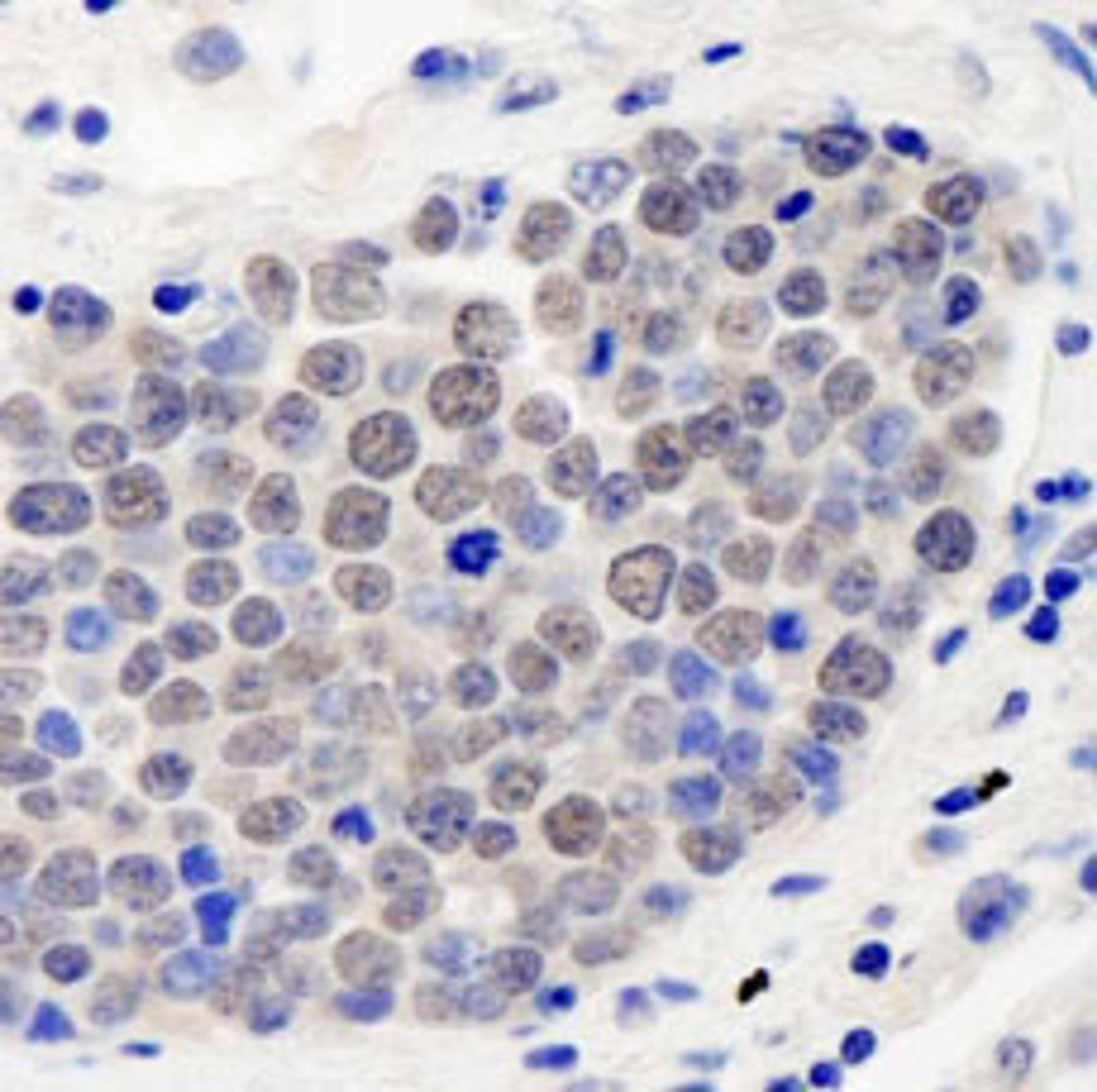 Detection of human CSN3 by immunohistochemistry.